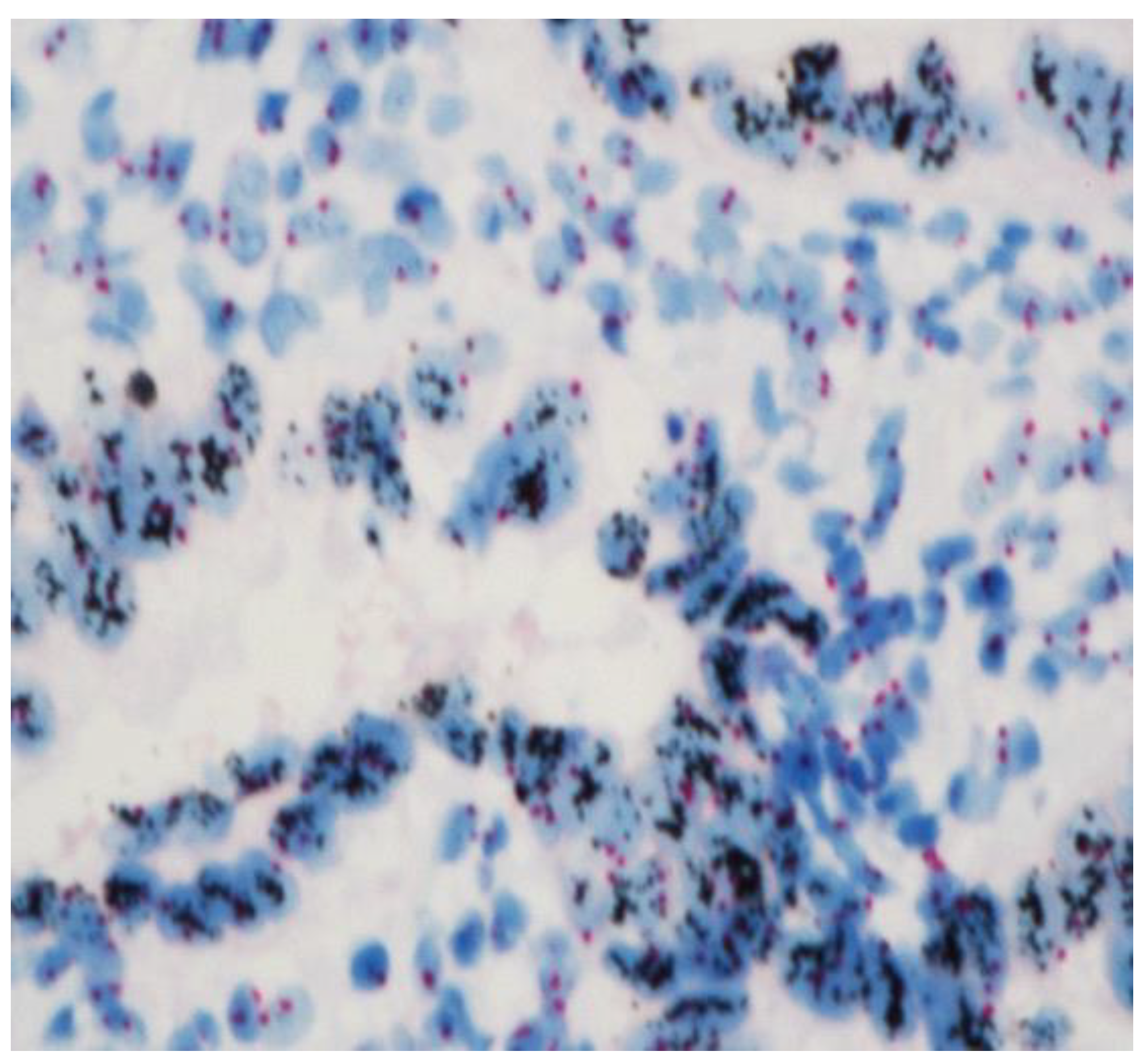 Cancers 15 01435 g003