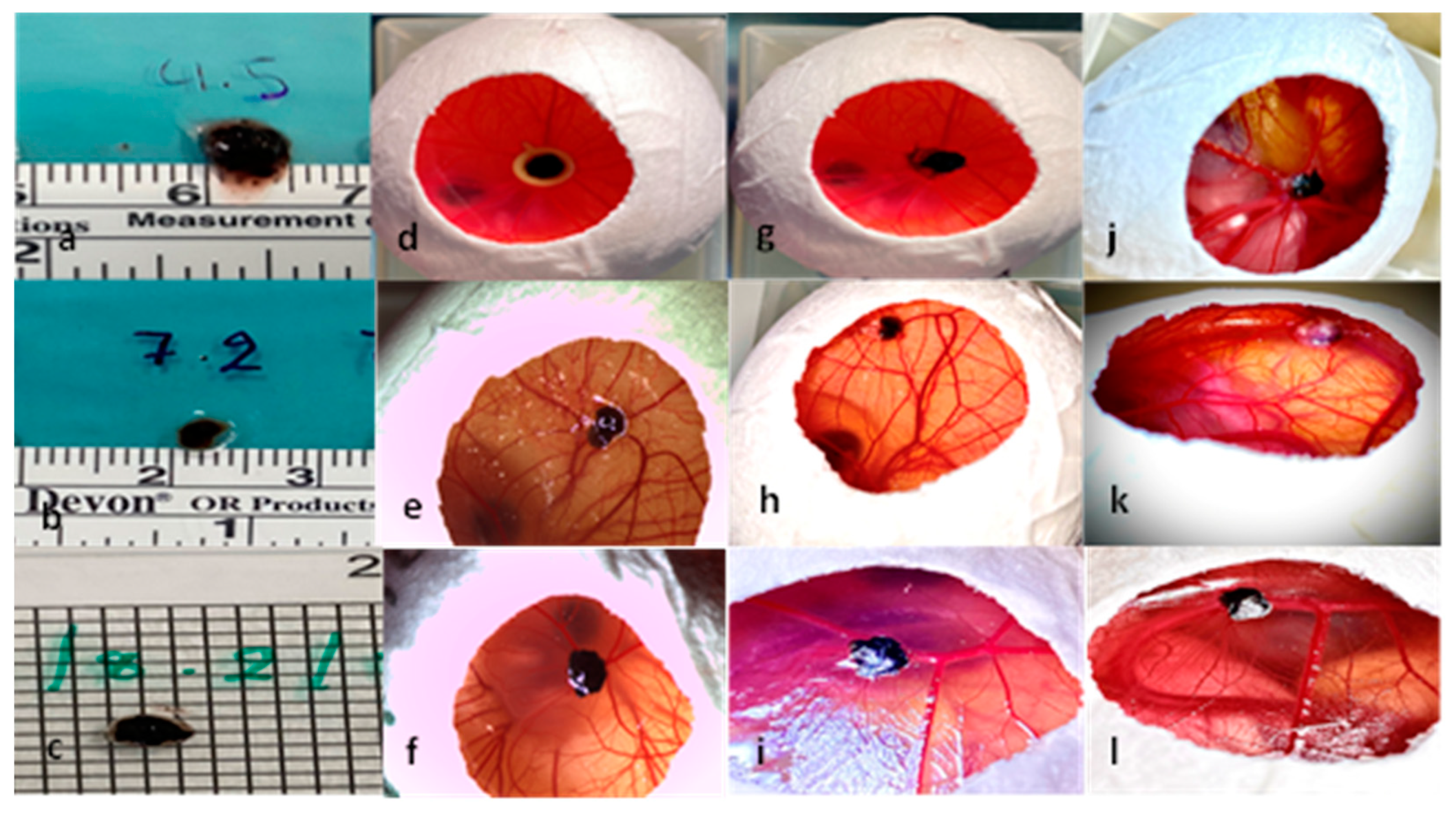 Cancers 15 01436 g002