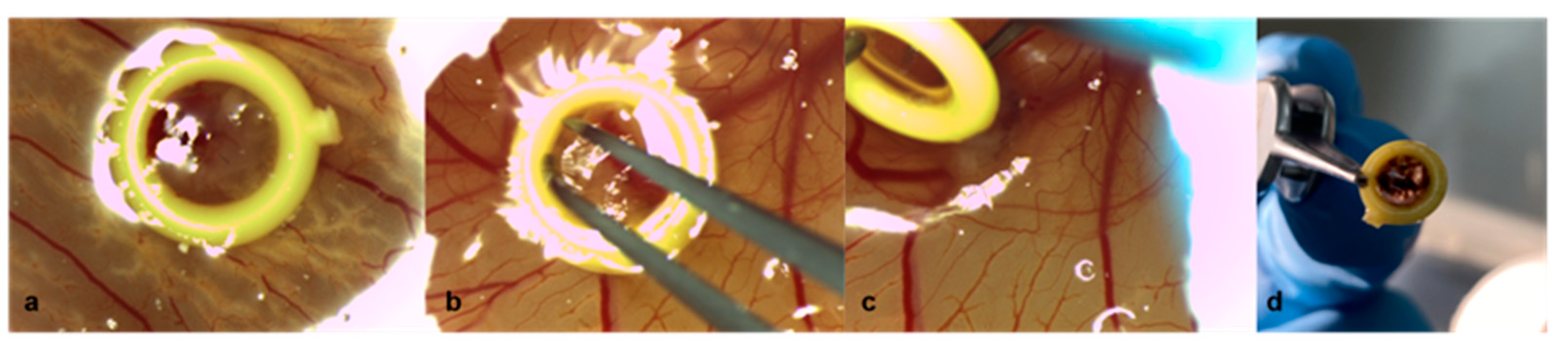 Cancers 15 01436 g005