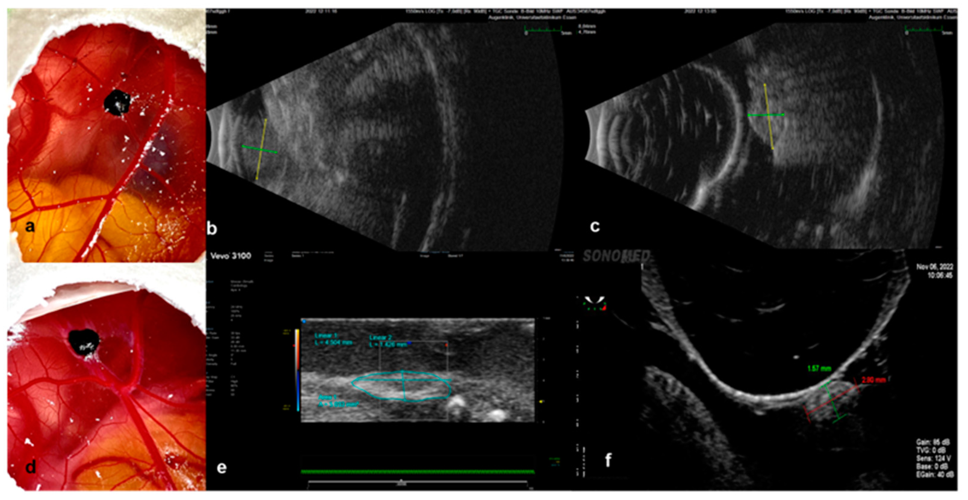 Cancers 15 01436 g007