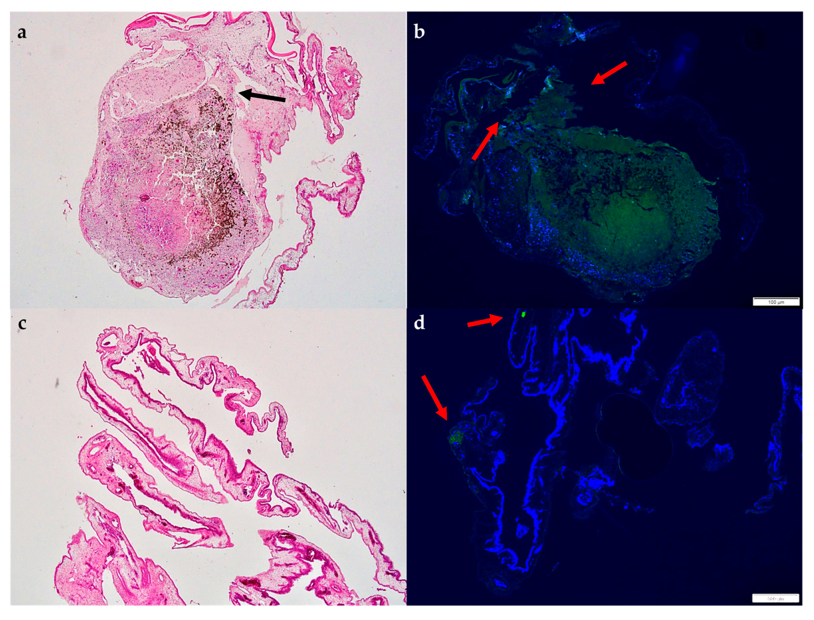 Cancers 15 01436 g012