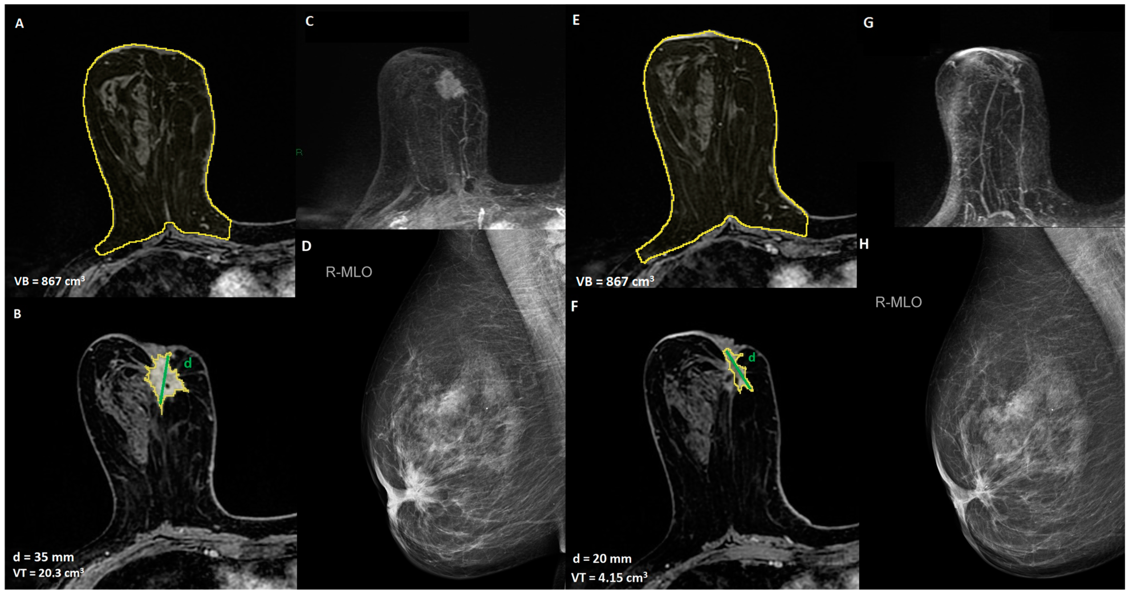 Cancers 15 01439 g001 Cancers 15 01439 g001