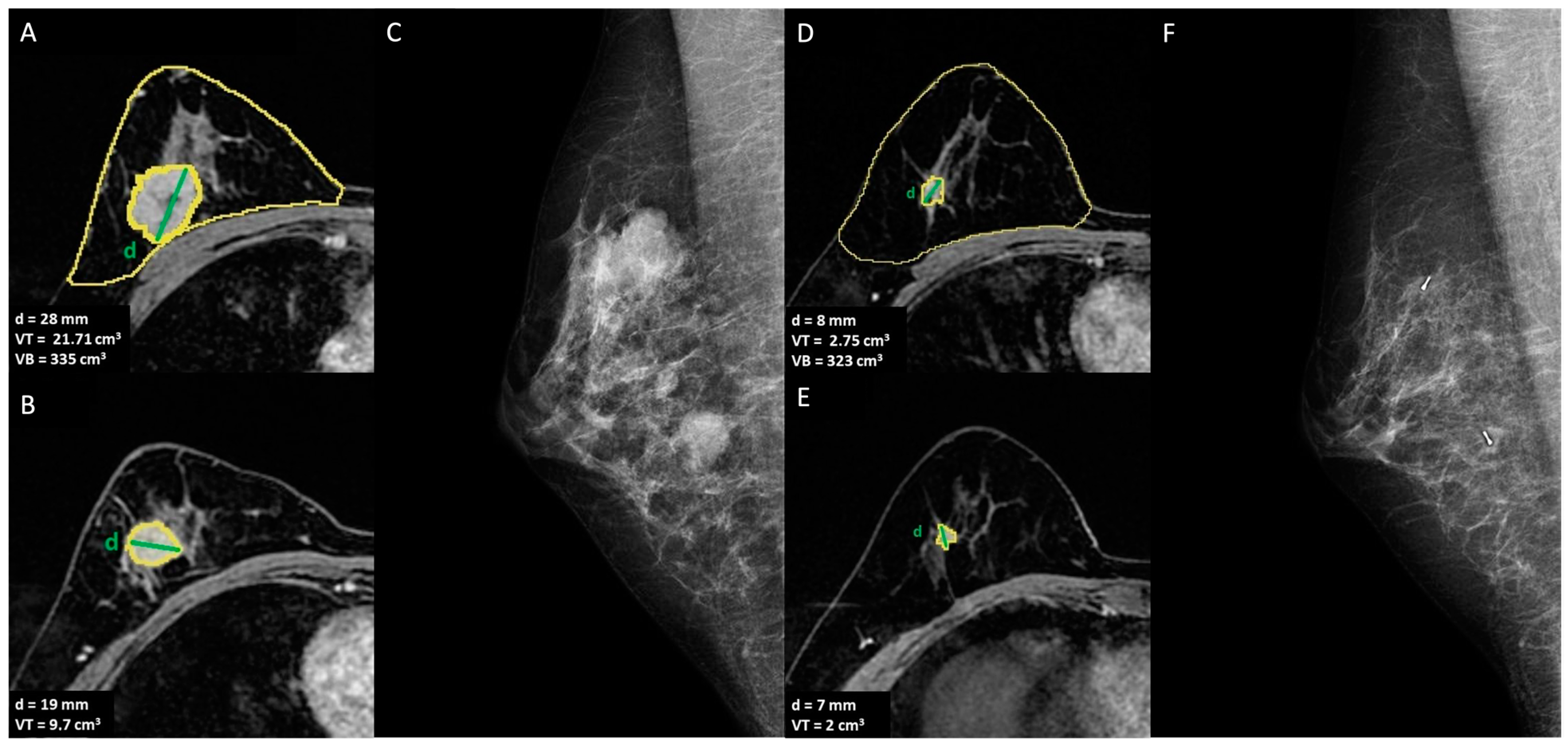 Cancers 15 01439 g002 Cancers 15 01439 g002