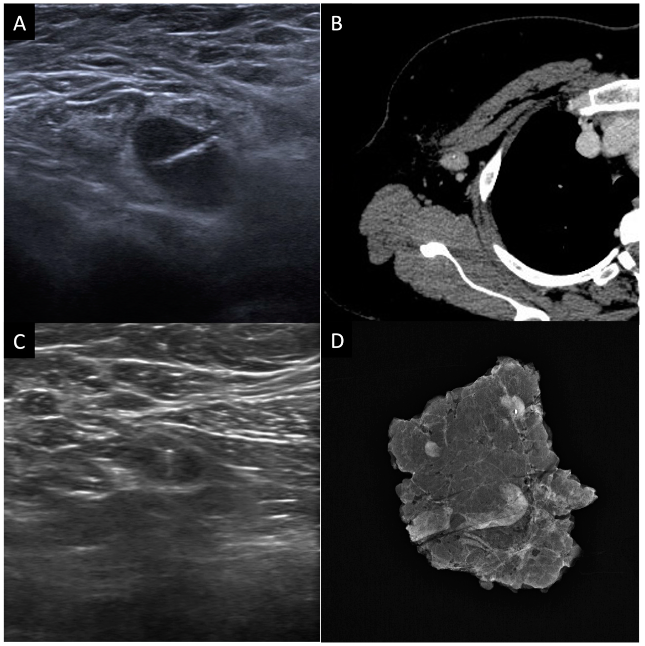 Cancers 15 01439 g003 Cancers 15 01439 g003