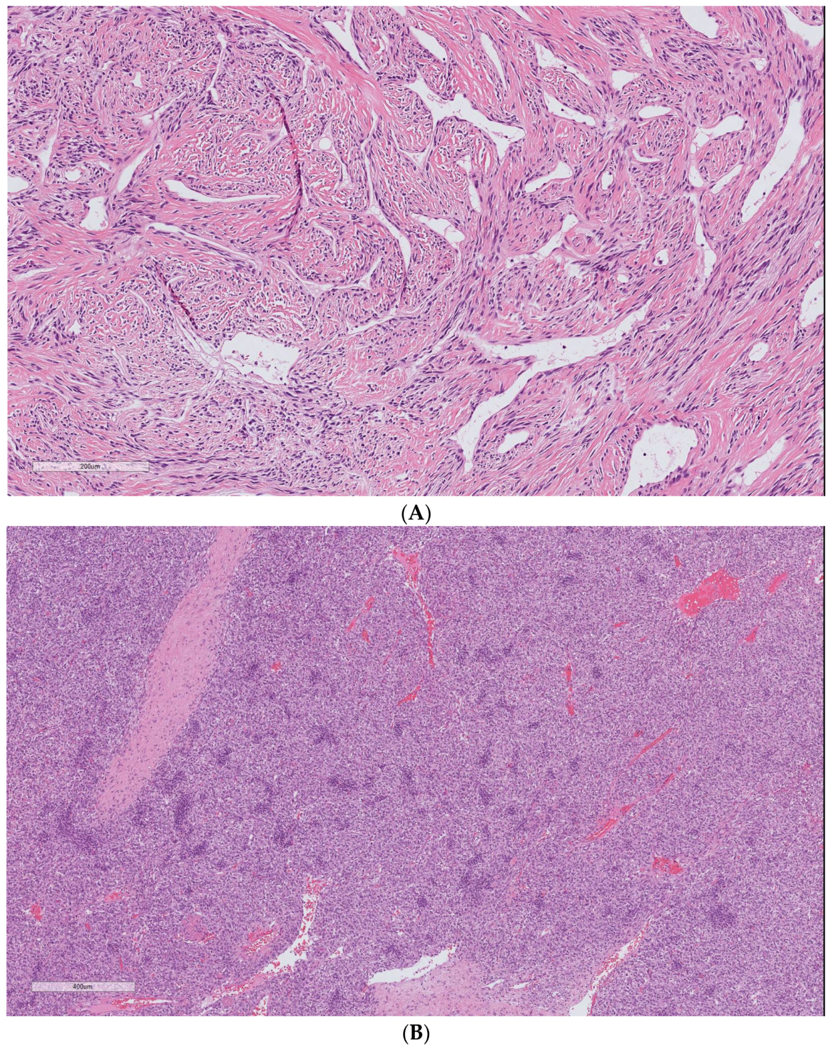 Cancers 15 01441 g002 Cancers 15 01441 g002