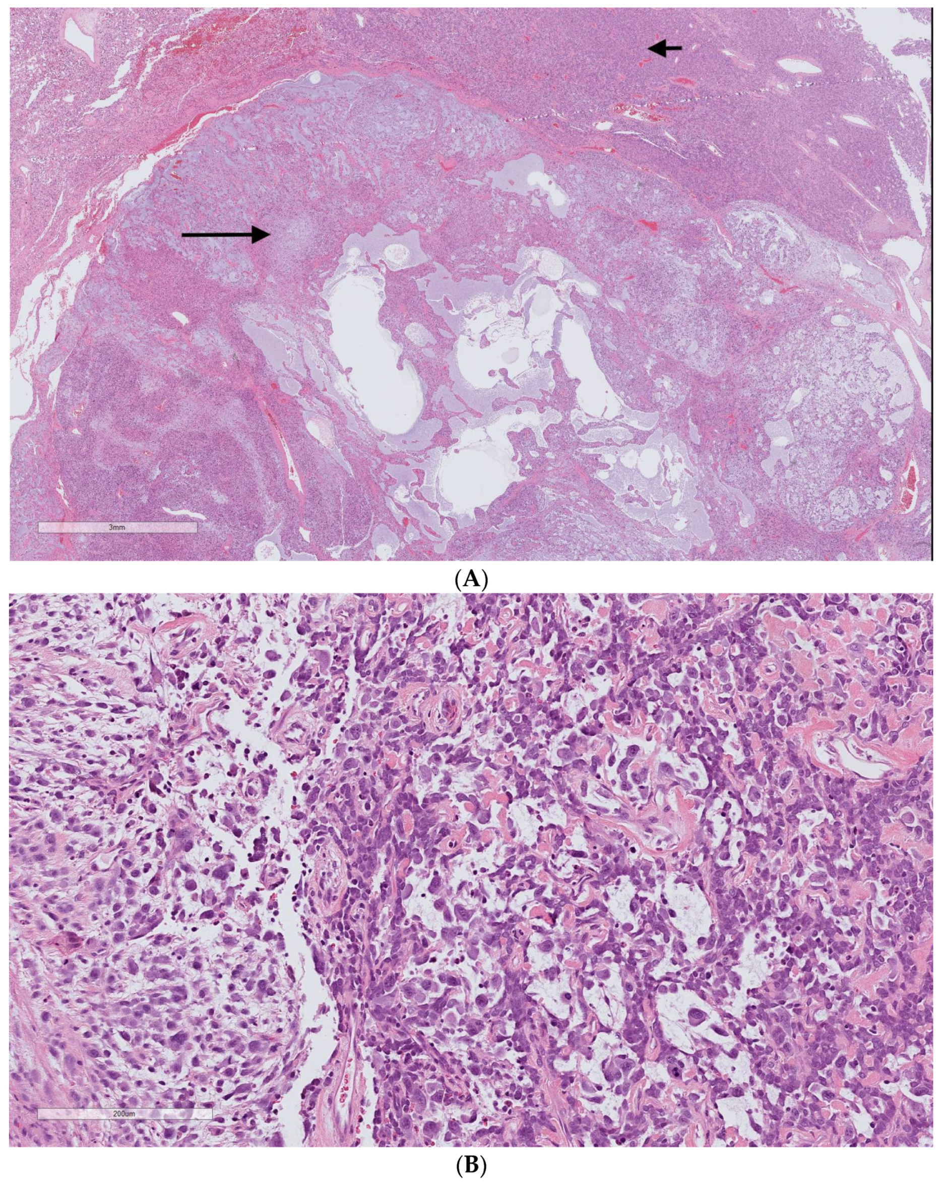 Cancers 15 01441 g006 Cancers 15 01441 g006