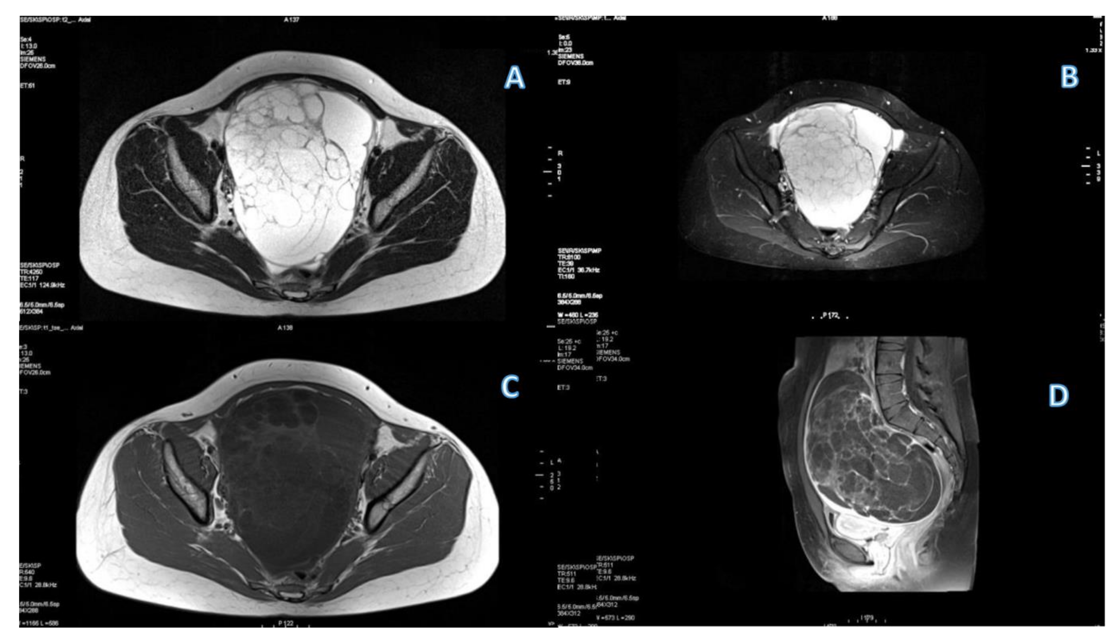 Cancers 15 01453 g004 Cancers 15 01453 g004