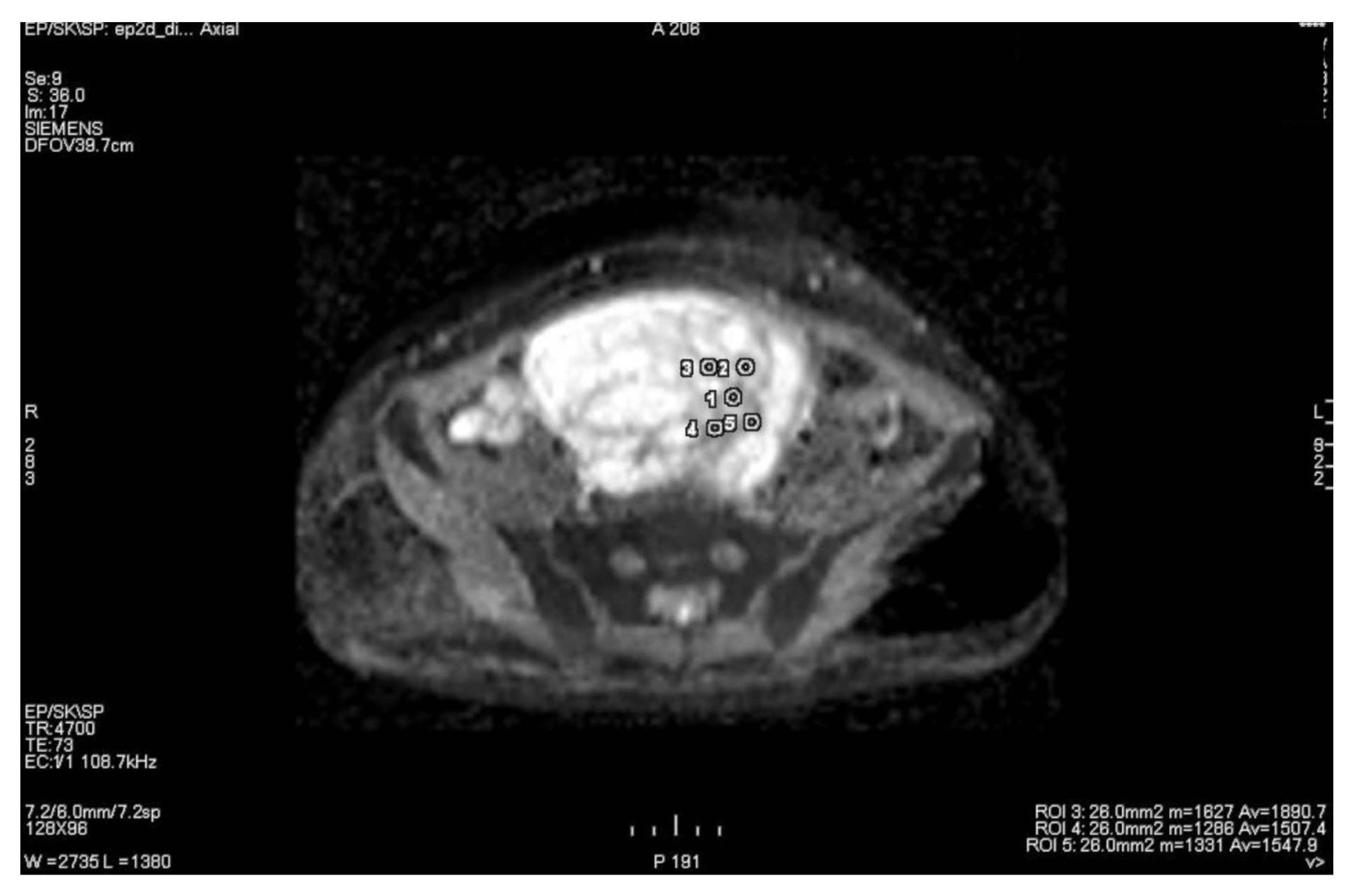 Cancers 15 01453 g005 Cancers 15 01453 g005