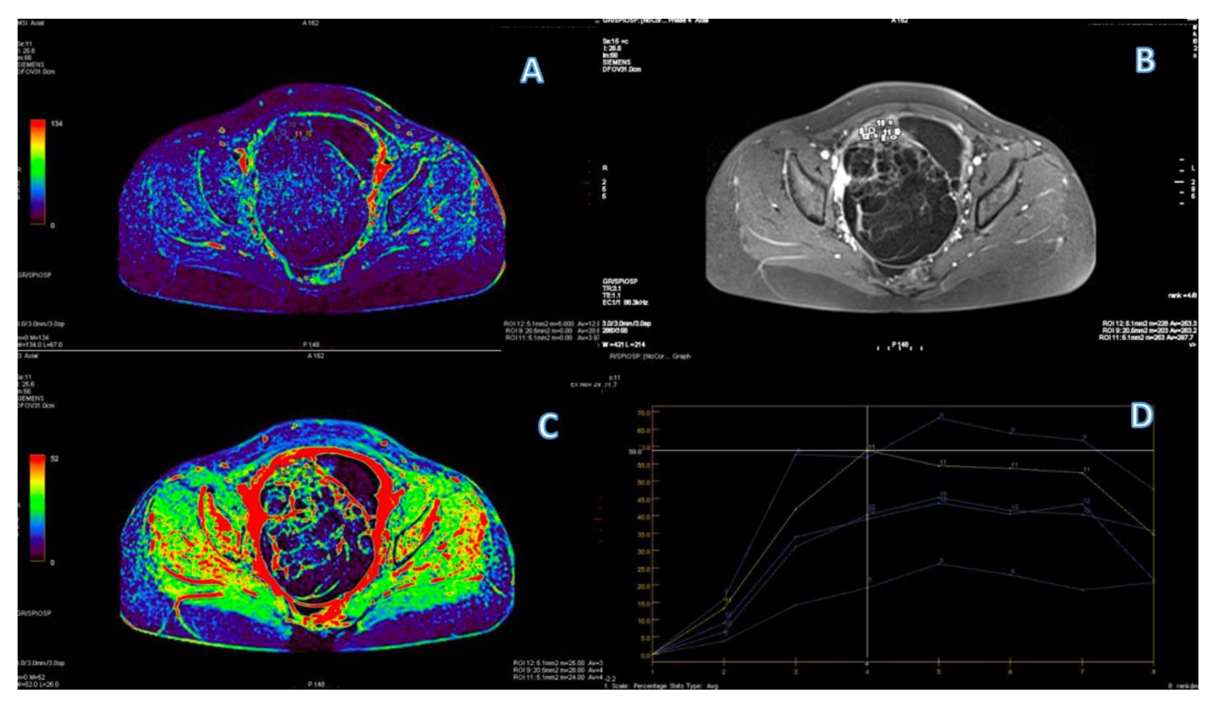 Cancers 15 01453 g006 Cancers 15 01453 g006