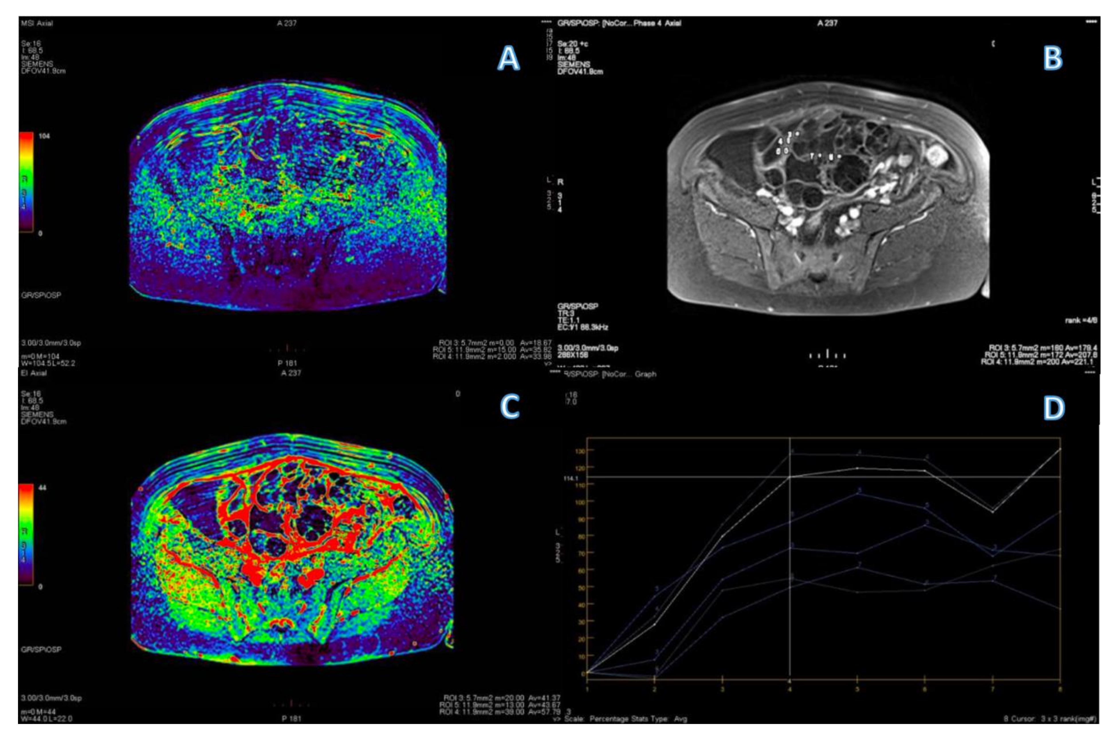 Cancers 15 01453 g008 Cancers 15 01453 g008