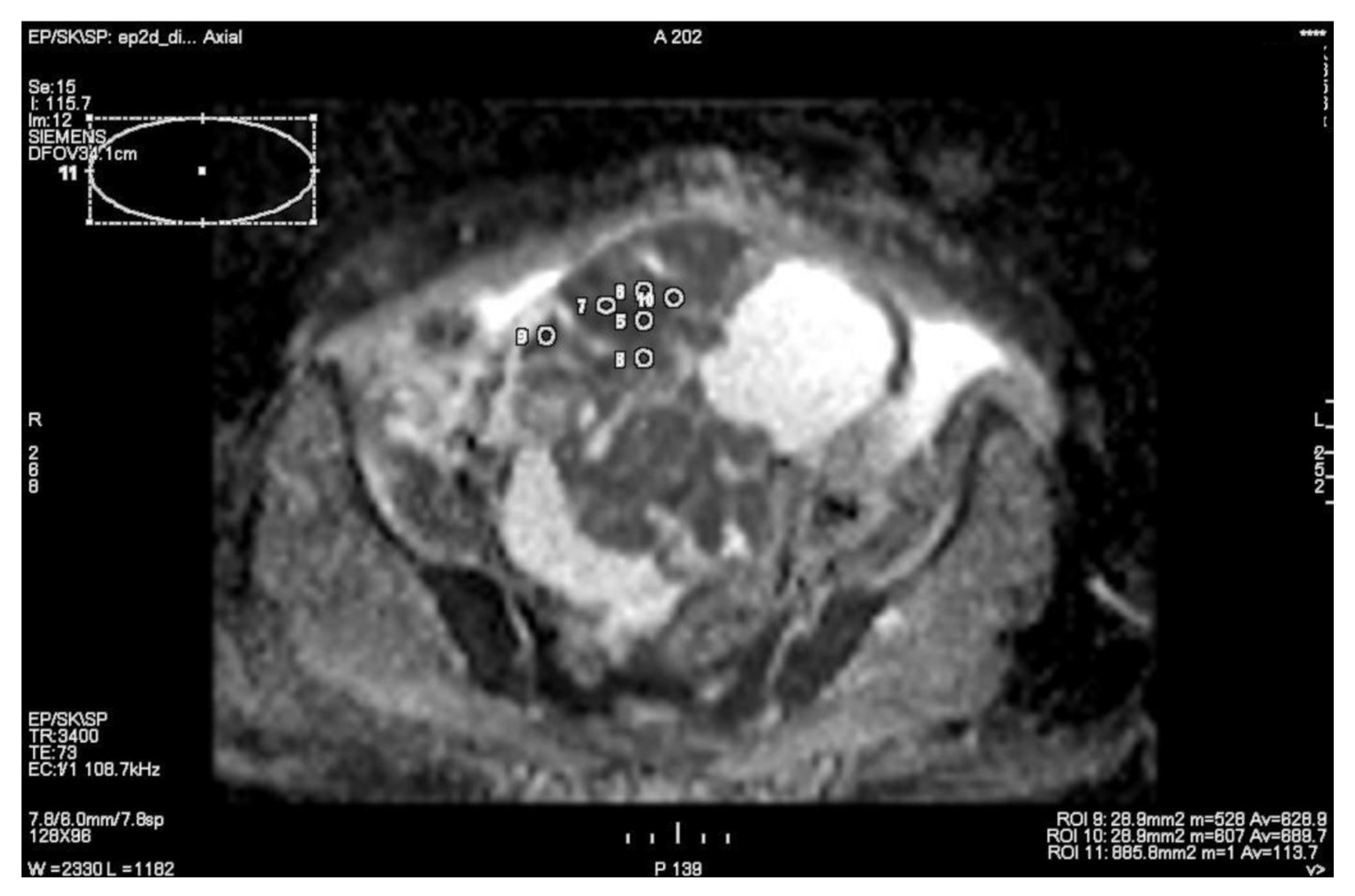 Cancers 15 01453 g009 Cancers 15 01453 g009