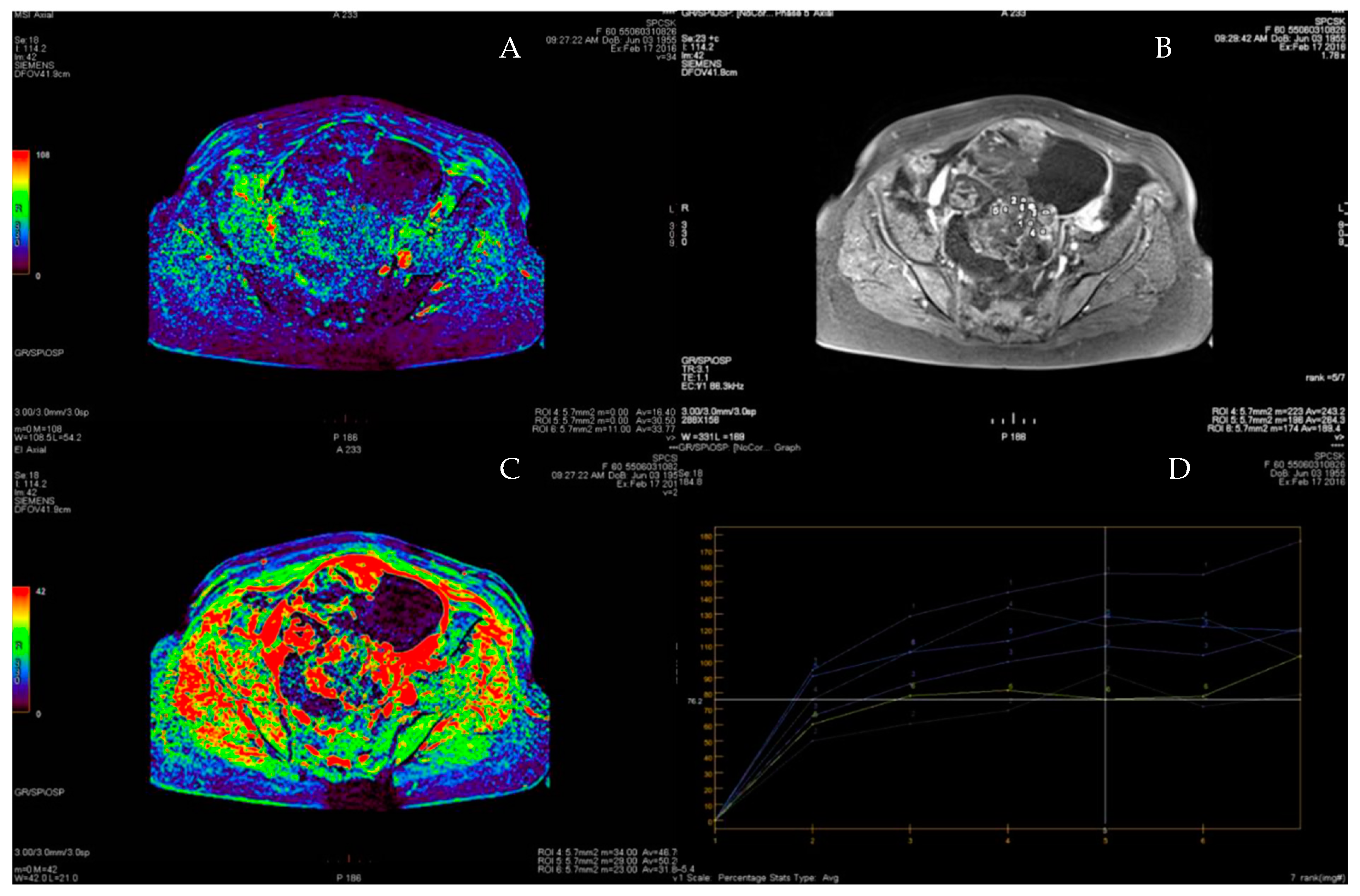 Cancers 15 01453 g010 Cancers 15 01453 g010