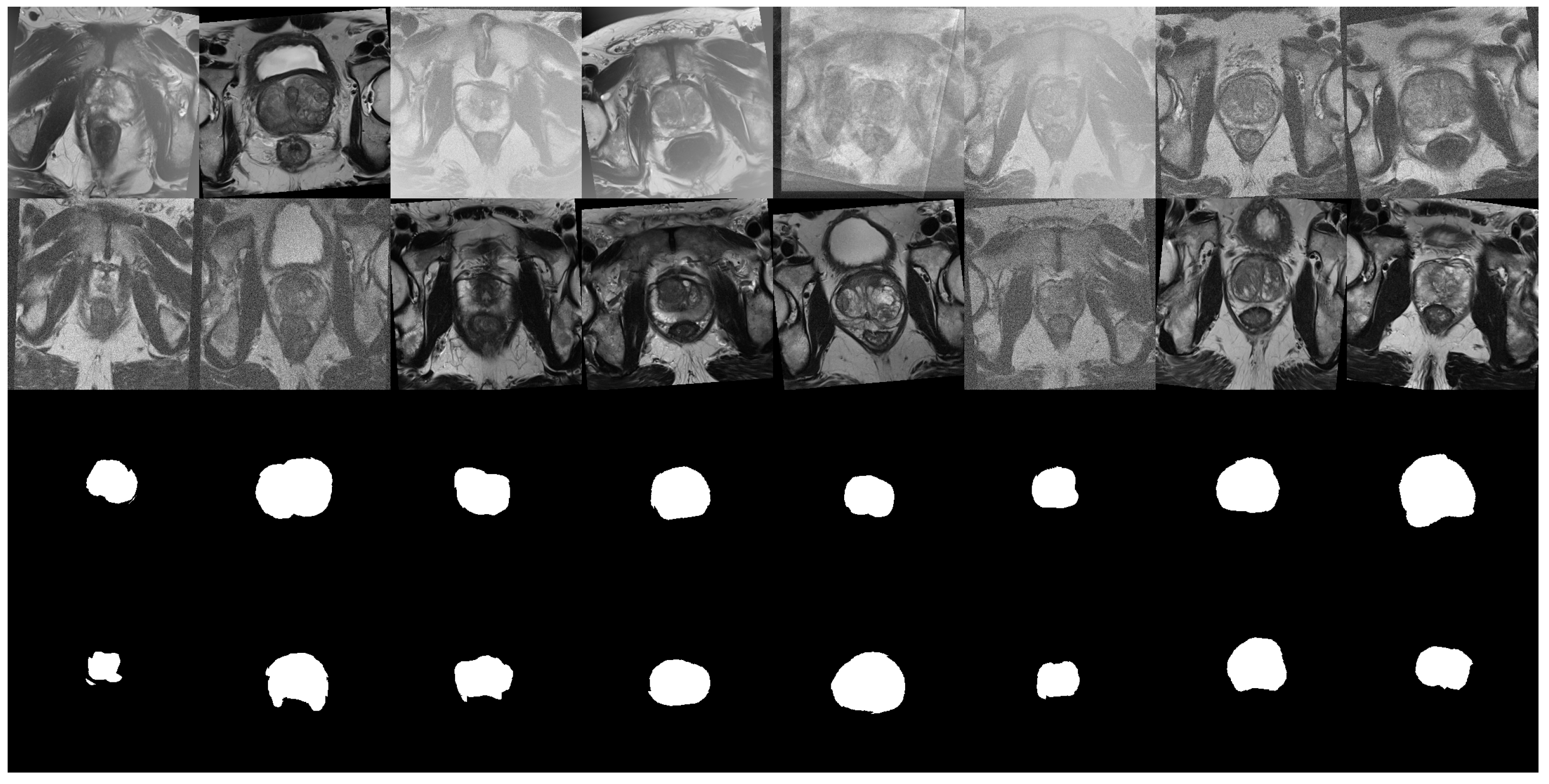 Cancers 15 01467 g002 Cancers 15 01467 g002