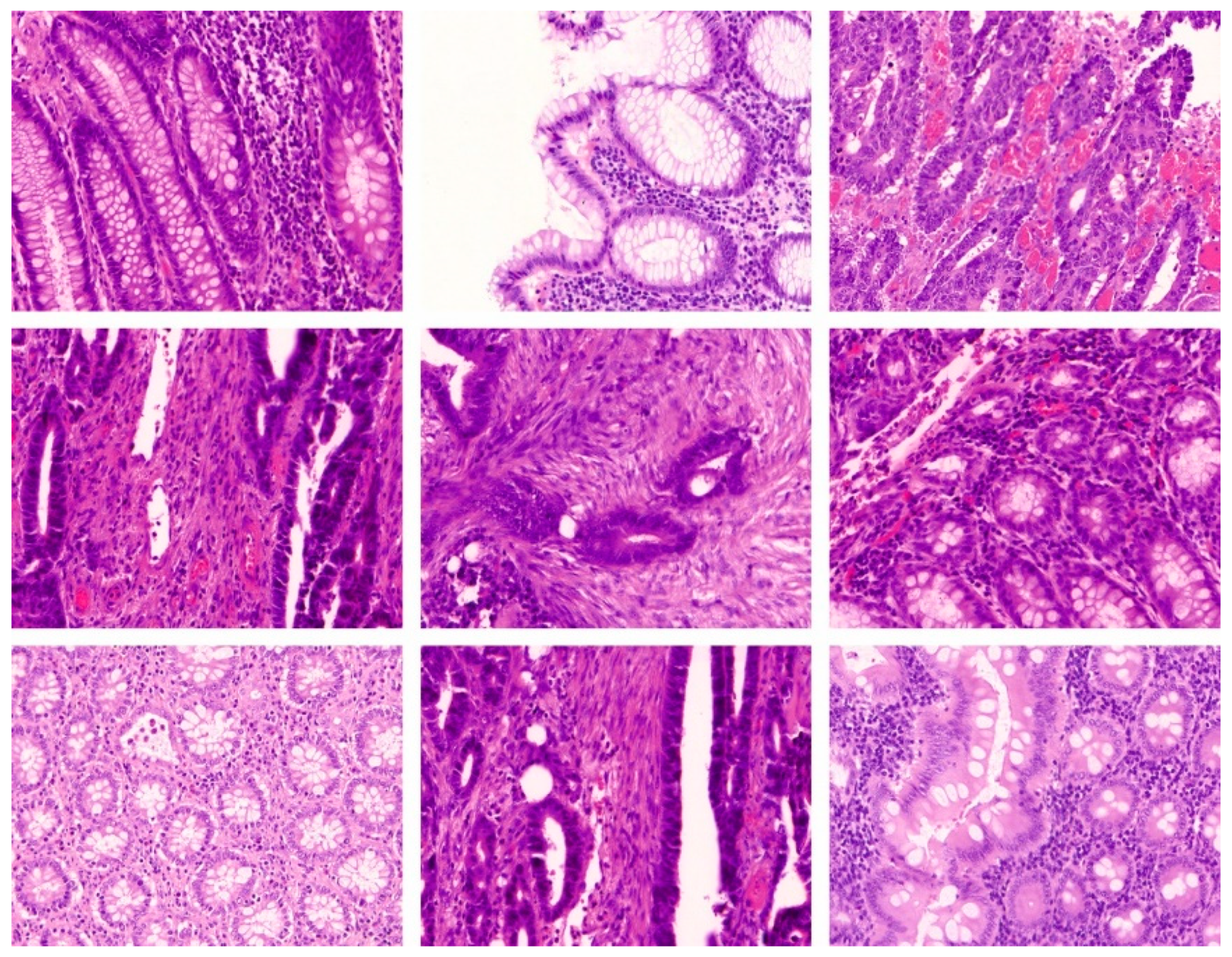 Cancers 15 01492 g004 Cancers 15 01492 g004