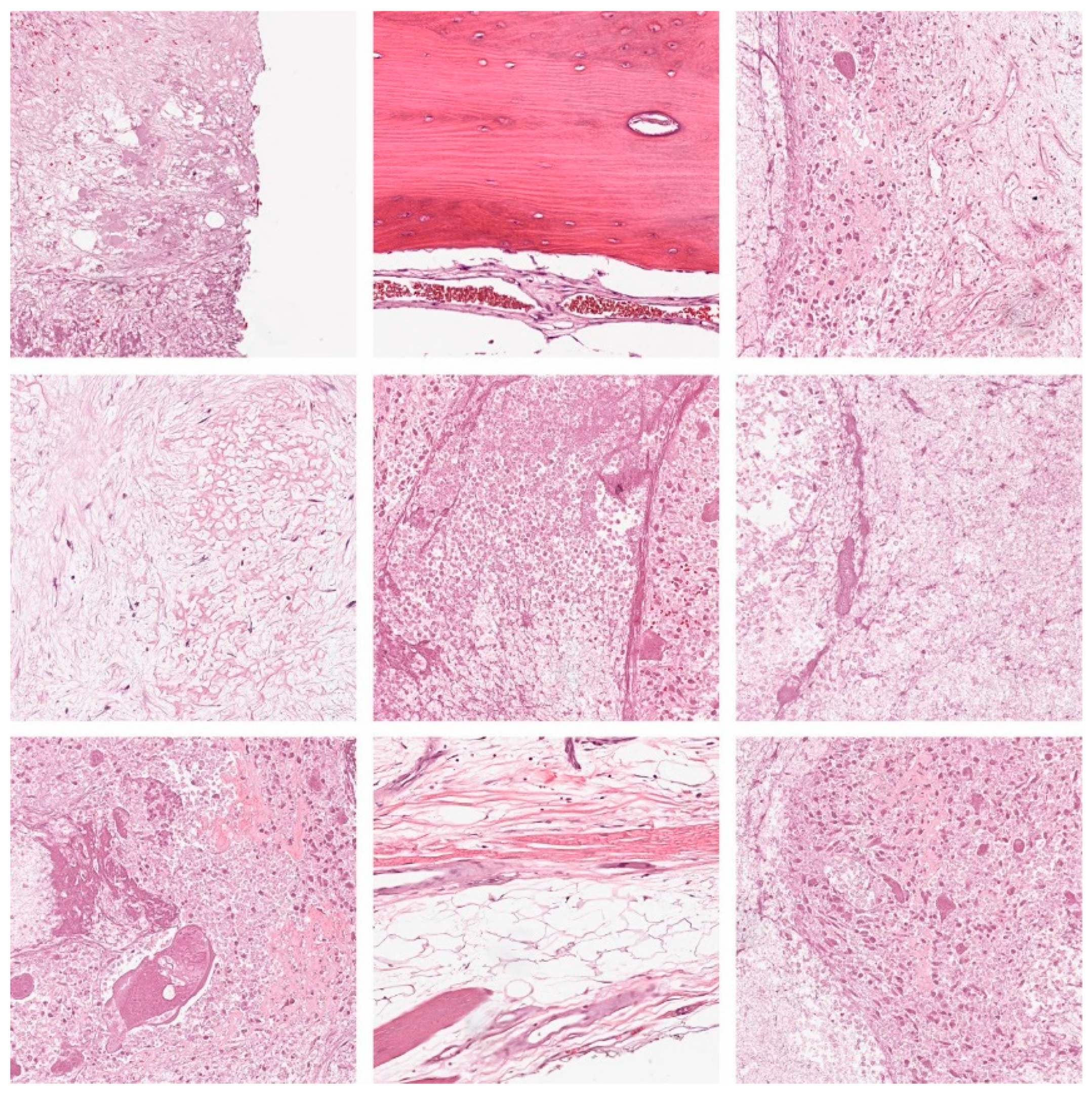 Cancers 15 01492 g005 Cancers 15 01492 g005