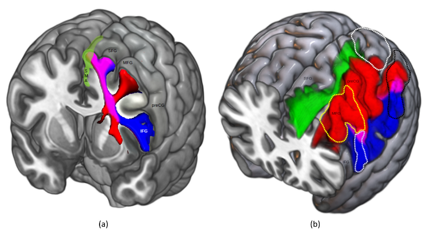 Cancers 15 01528 g003 Cancers 15 01528 g003