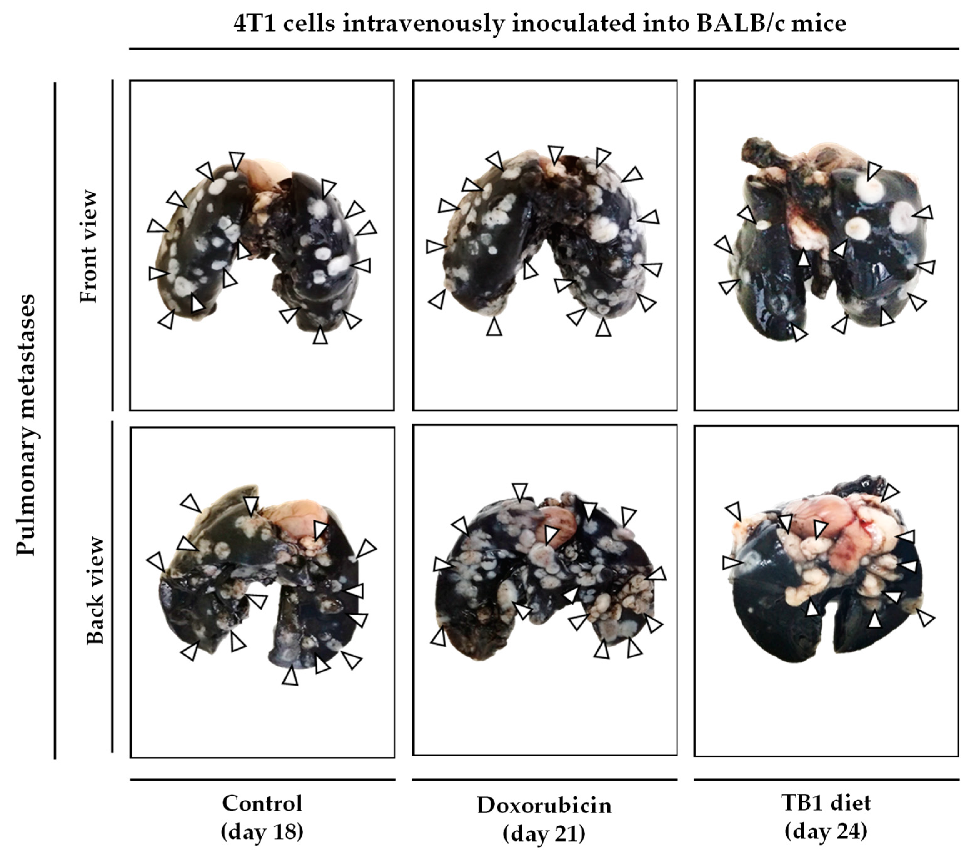 Cancers 15 01540 g004 Cancers 15 01540 g004