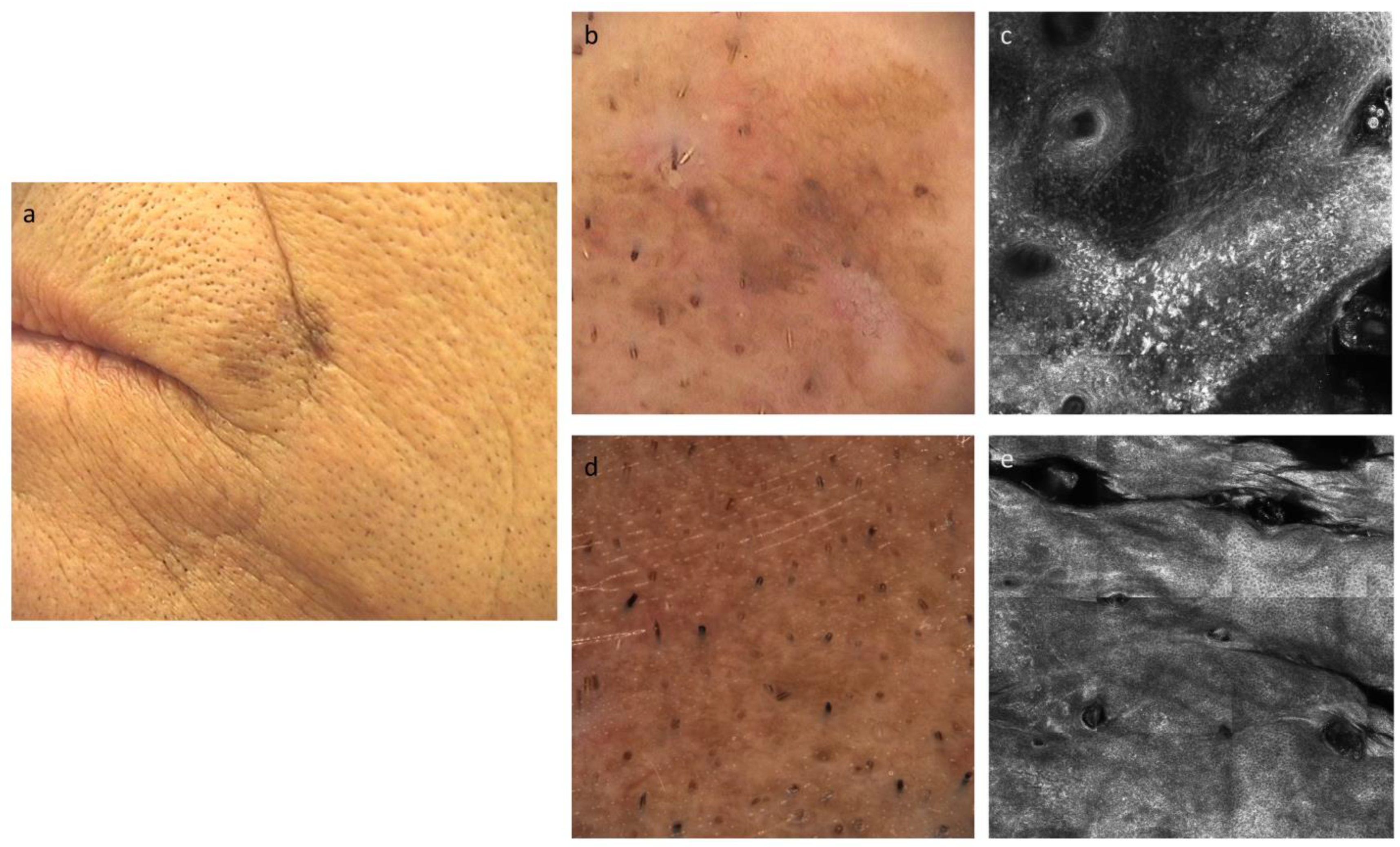 Cancers 15 01546 g003 Cancers 15 01546 g003