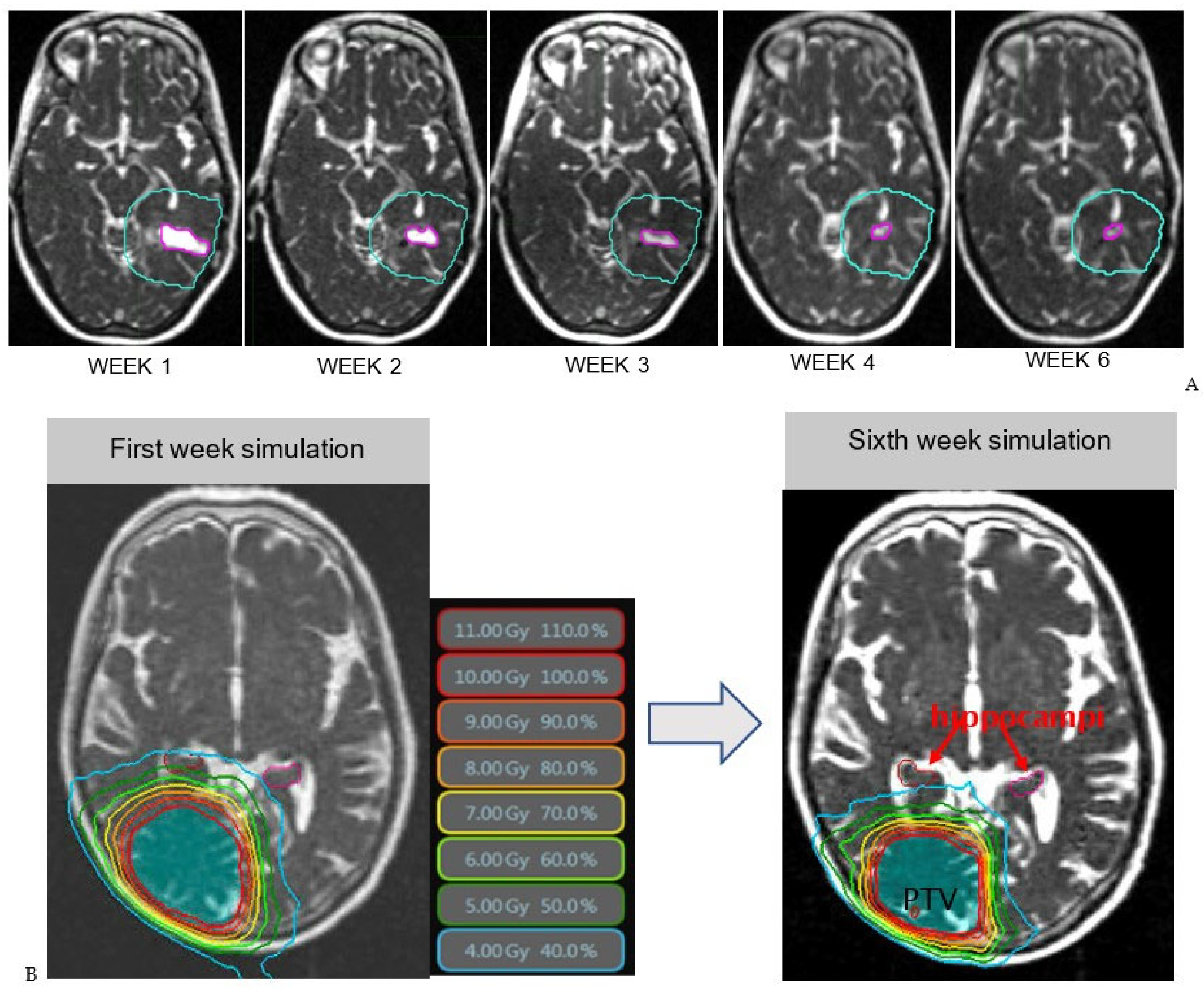 Cancers 15 01555 g003