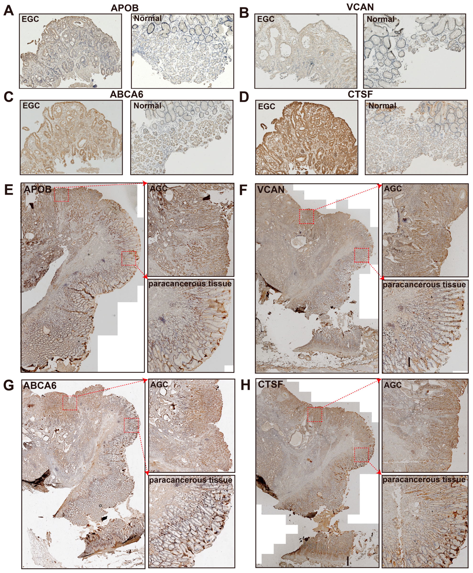 Cancers 15 01610 g005 Cancers 15 01610 g005