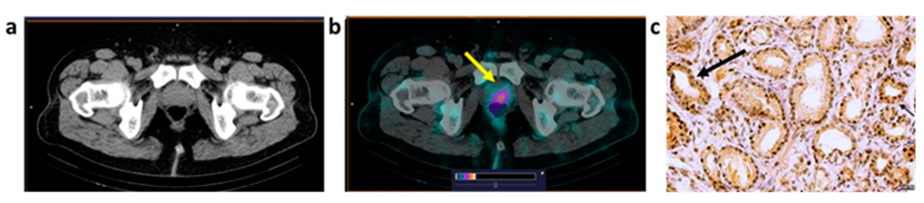 Cancers 15 01631 g005 Cancers 15 01631 g005