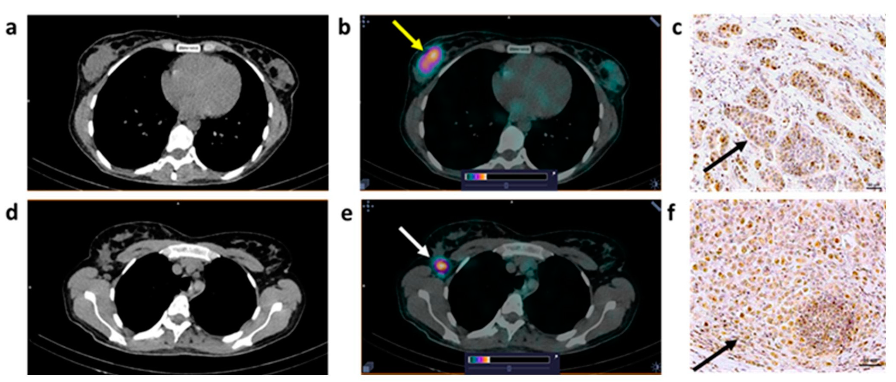 Cancers 15 01631 g006 Cancers 15 01631 g006