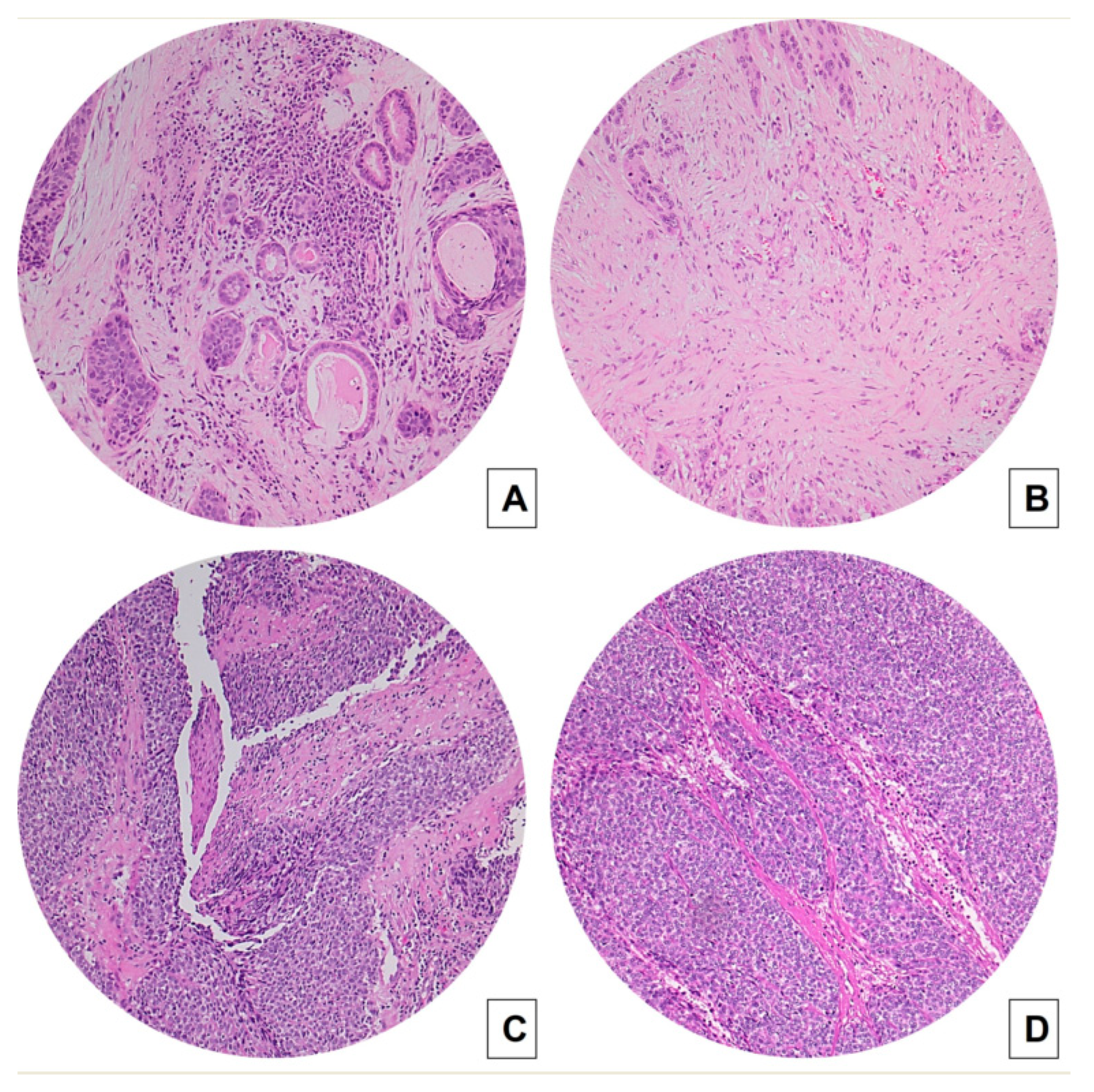 Cancers 15 01645 g001 Cancers 15 01645 g001