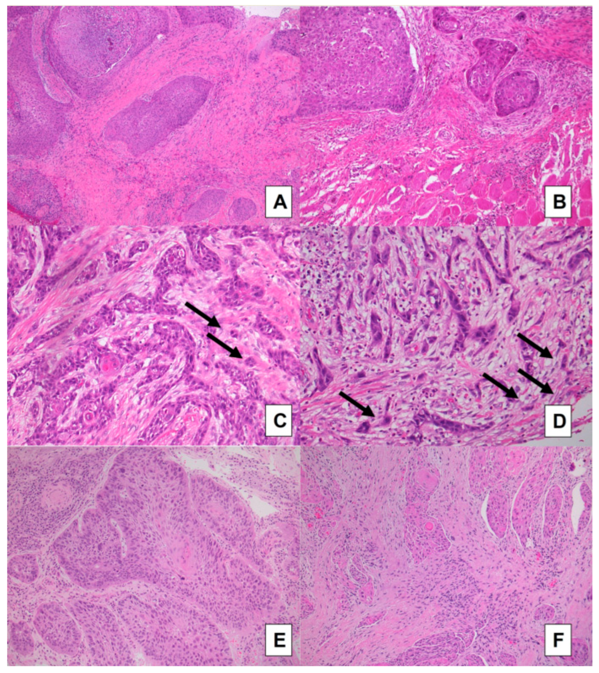 Cancers 15 01645 g002 Cancers 15 01645 g002