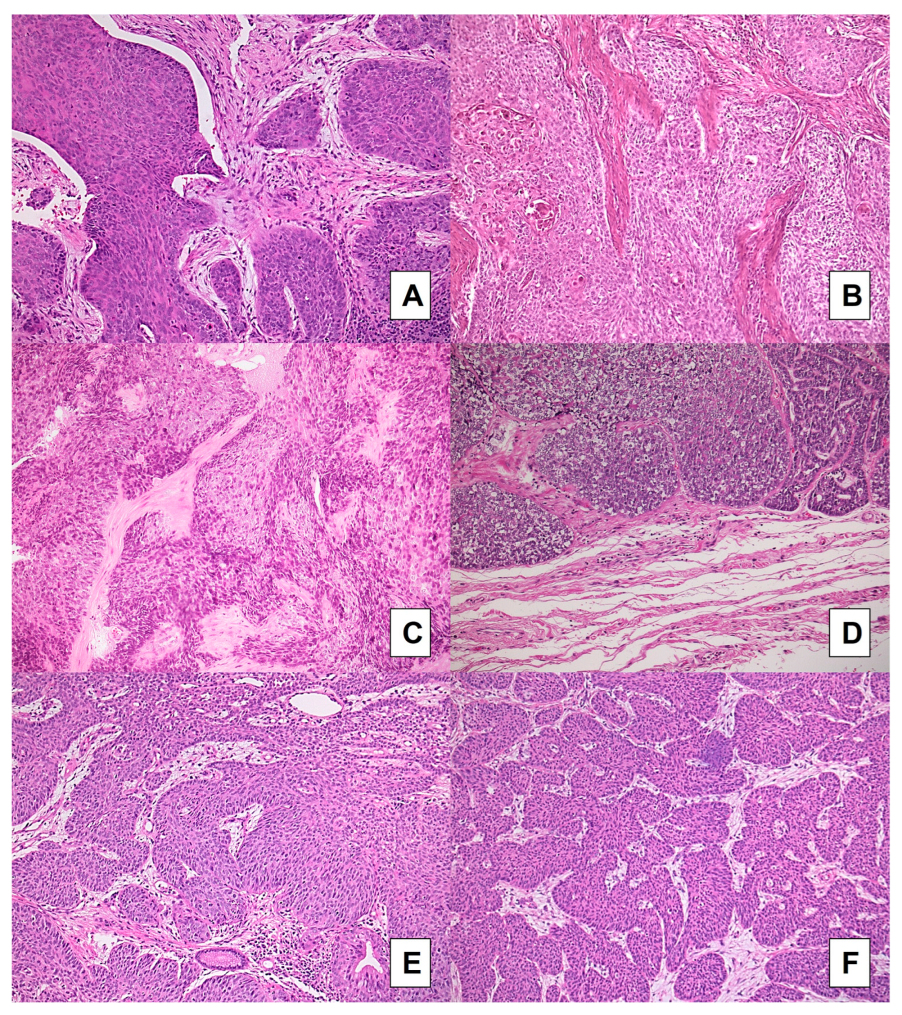 Cancers 15 01645 g003 Cancers 15 01645 g003