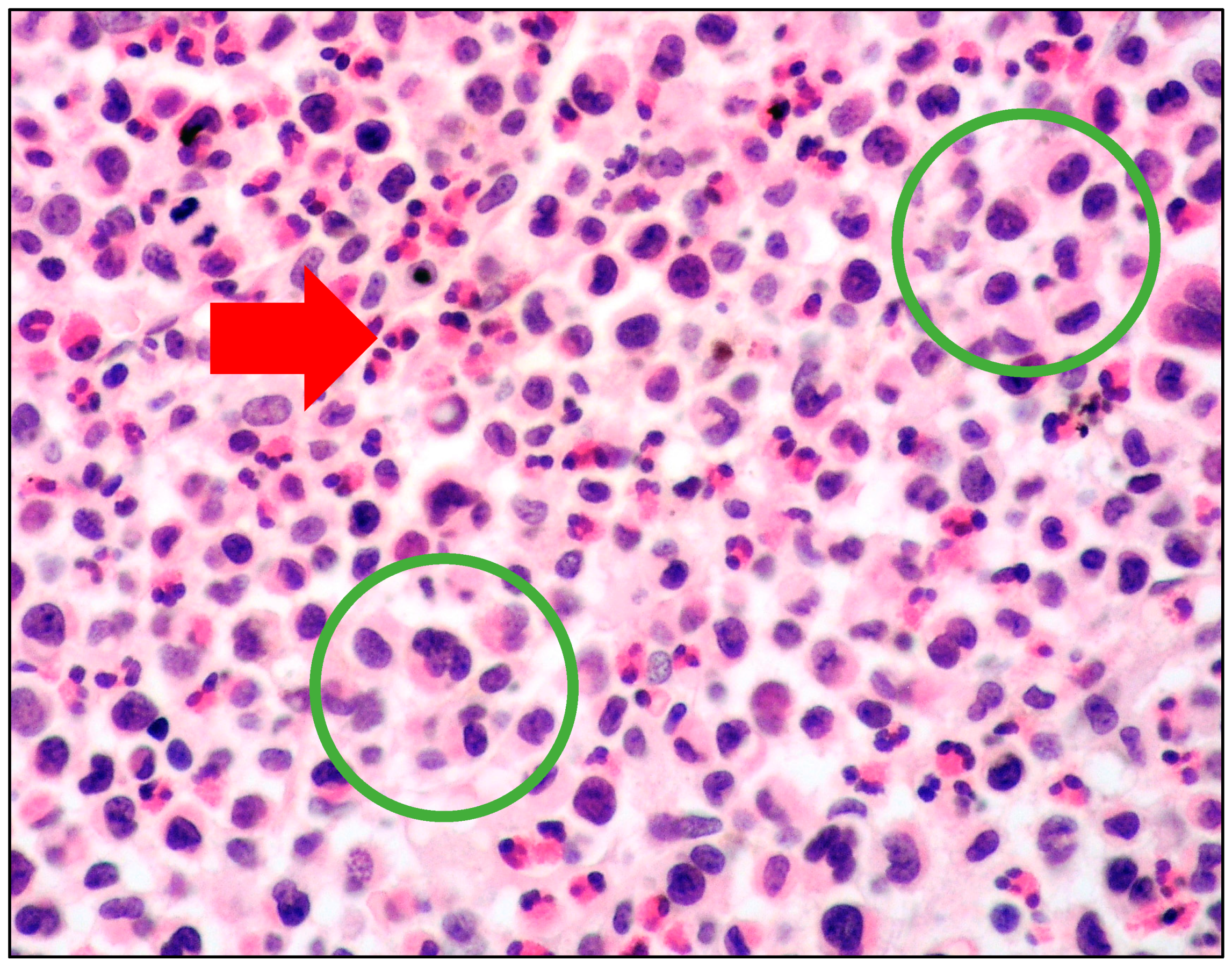 Cancers 15 01664 g002 Cancers 15 01664 g002