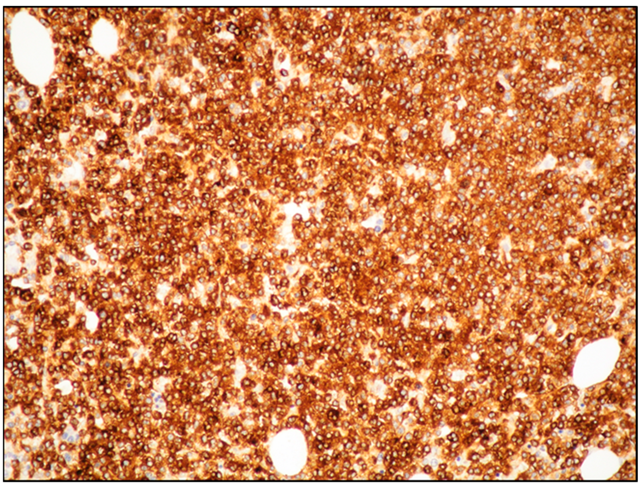 Cancers 15 01664 g003 Cancers 15 01664 g003