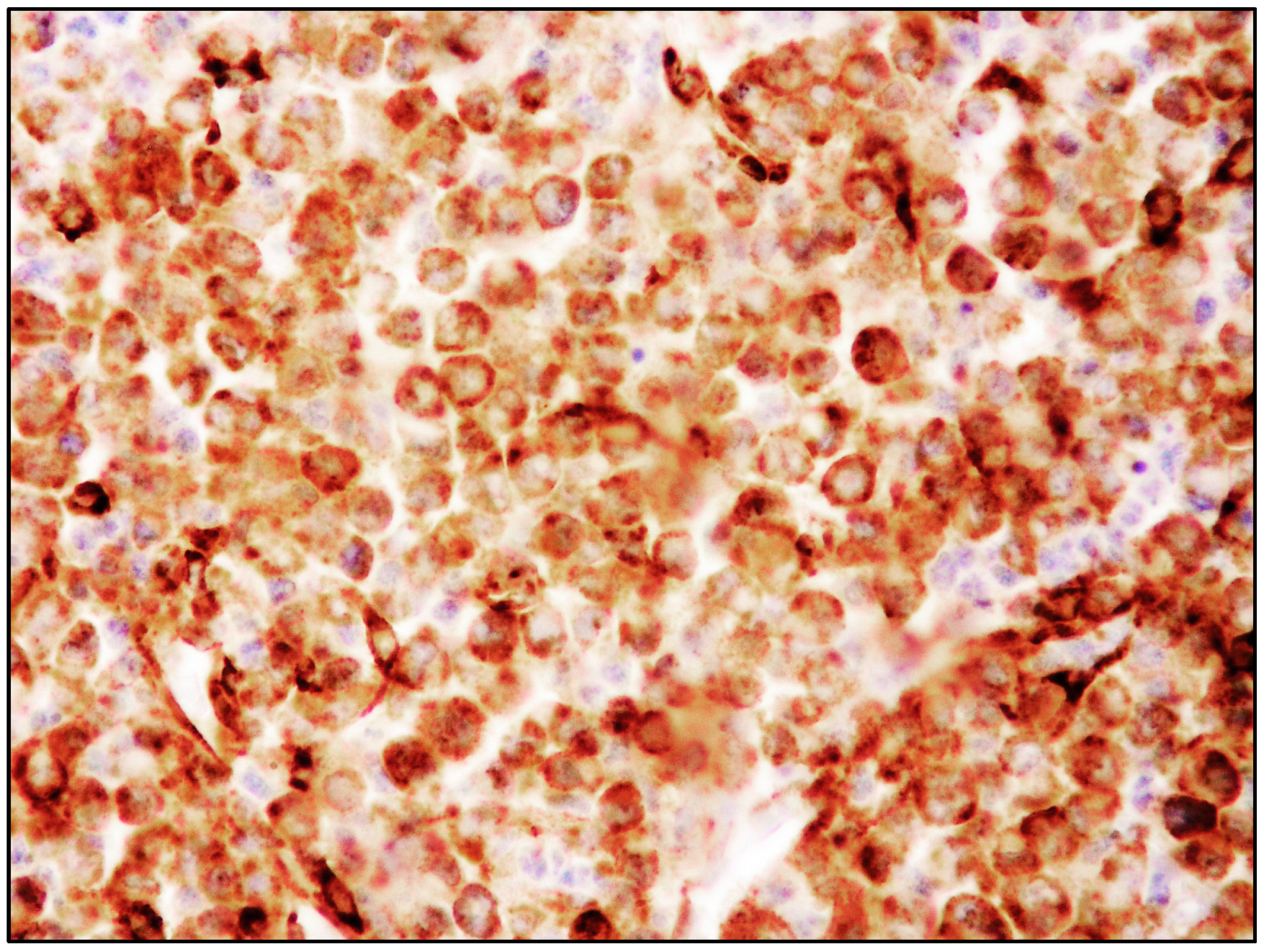 Cancers 15 01664 g005 Cancers 15 01664 g005