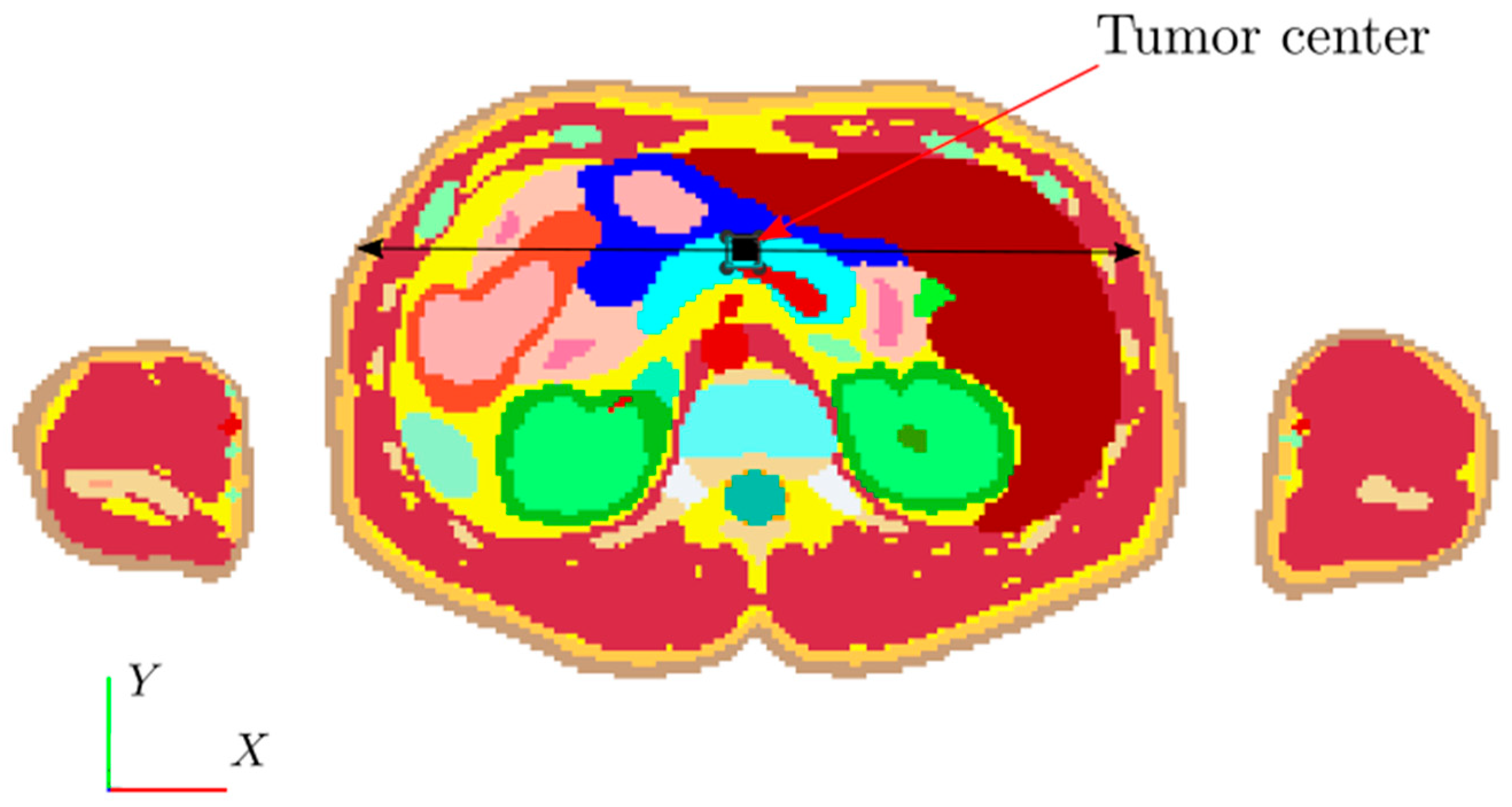 Cancers 15 01672 g011 Cancers 15 01672 g011