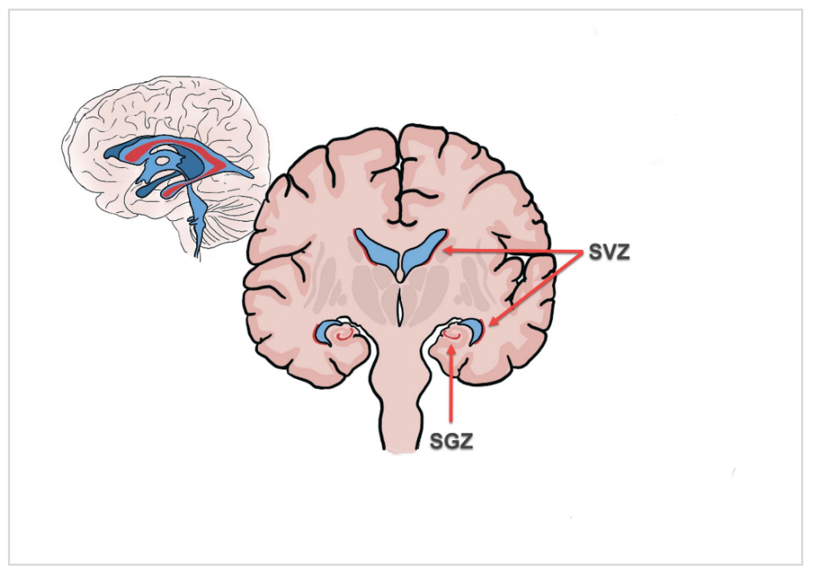 Cancers | Free Full-Text | Therapy Resistance of Glioblastoma in ...