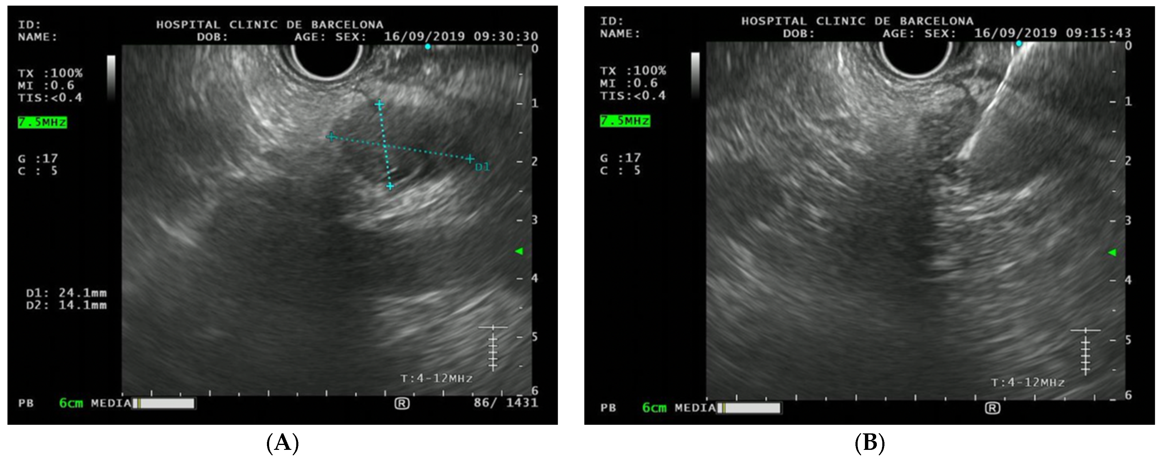 Cancers 15 01690 g003 Cancers 15 01690 g003