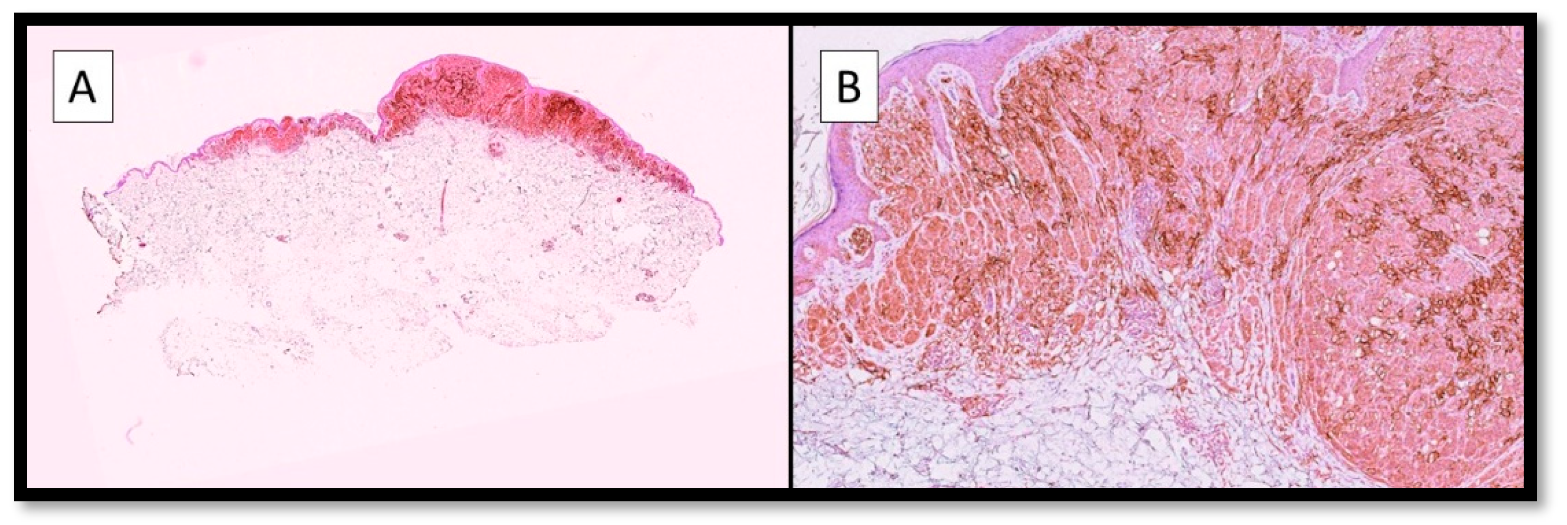 Cancers 15 01697 g002 Cancers 15 01697 g002