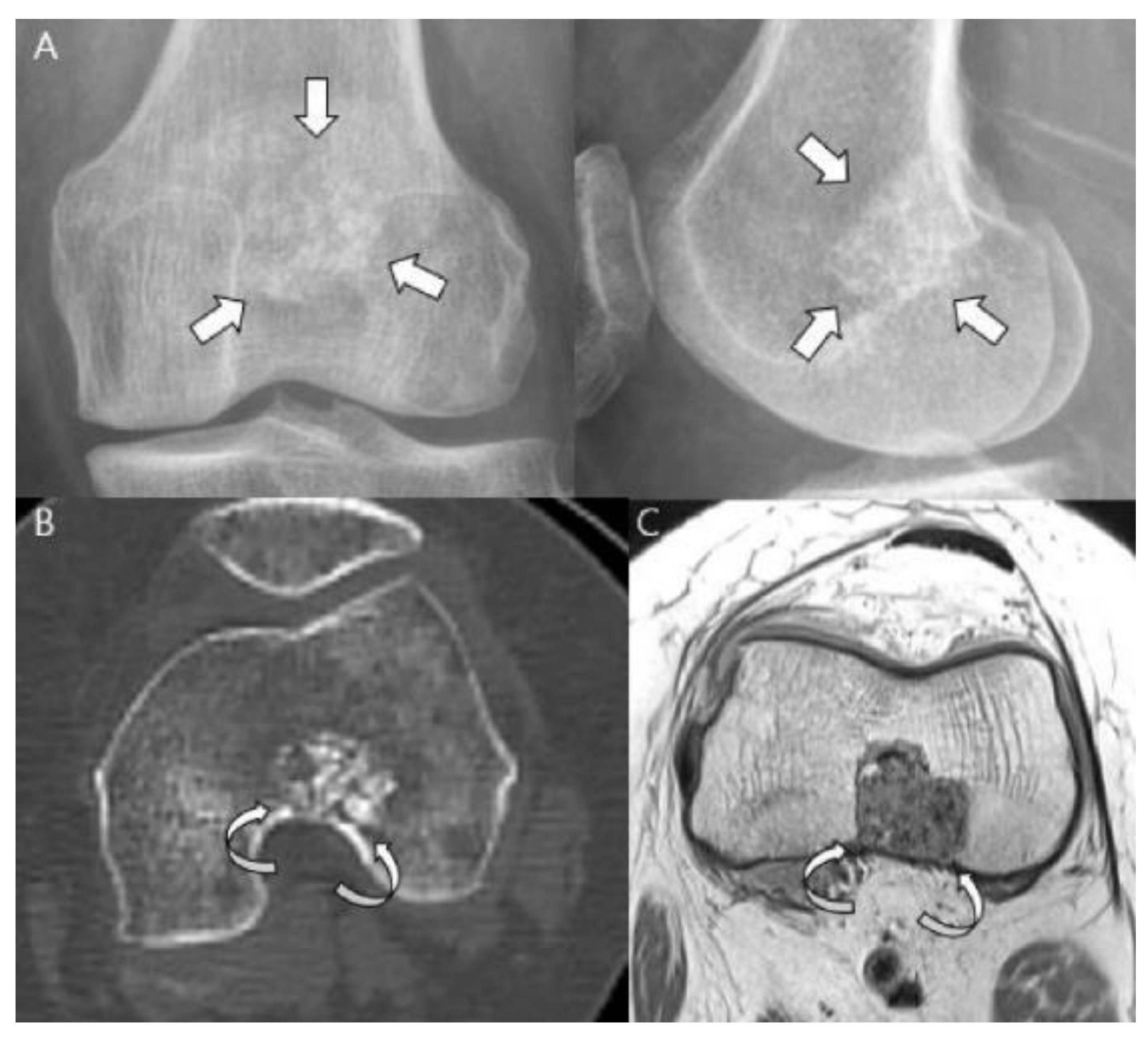 Cancers 15 01703 g003 Cancers 15 01703 g003