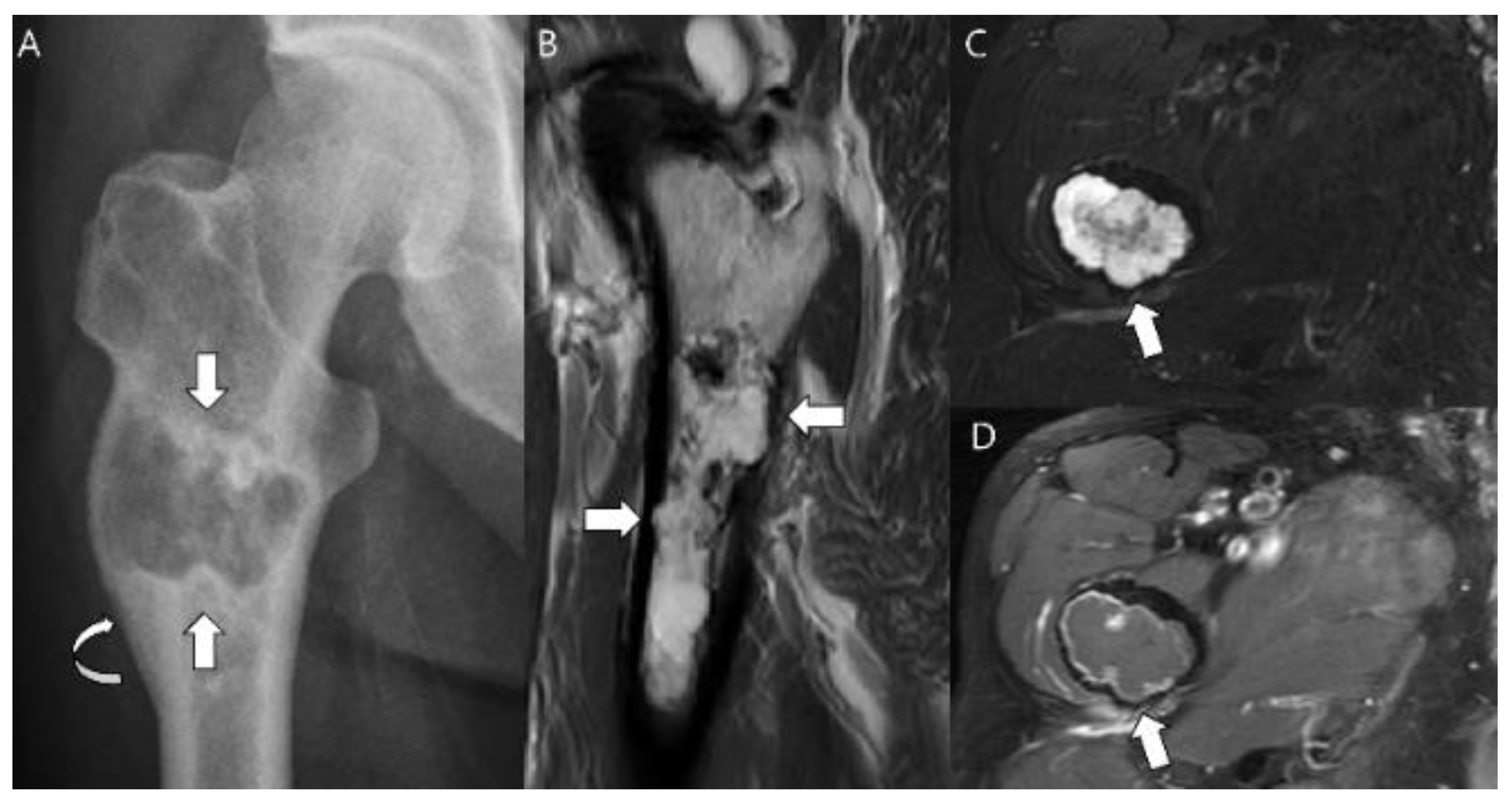 Cancers 15 01703 g005 Cancers 15 01703 g005