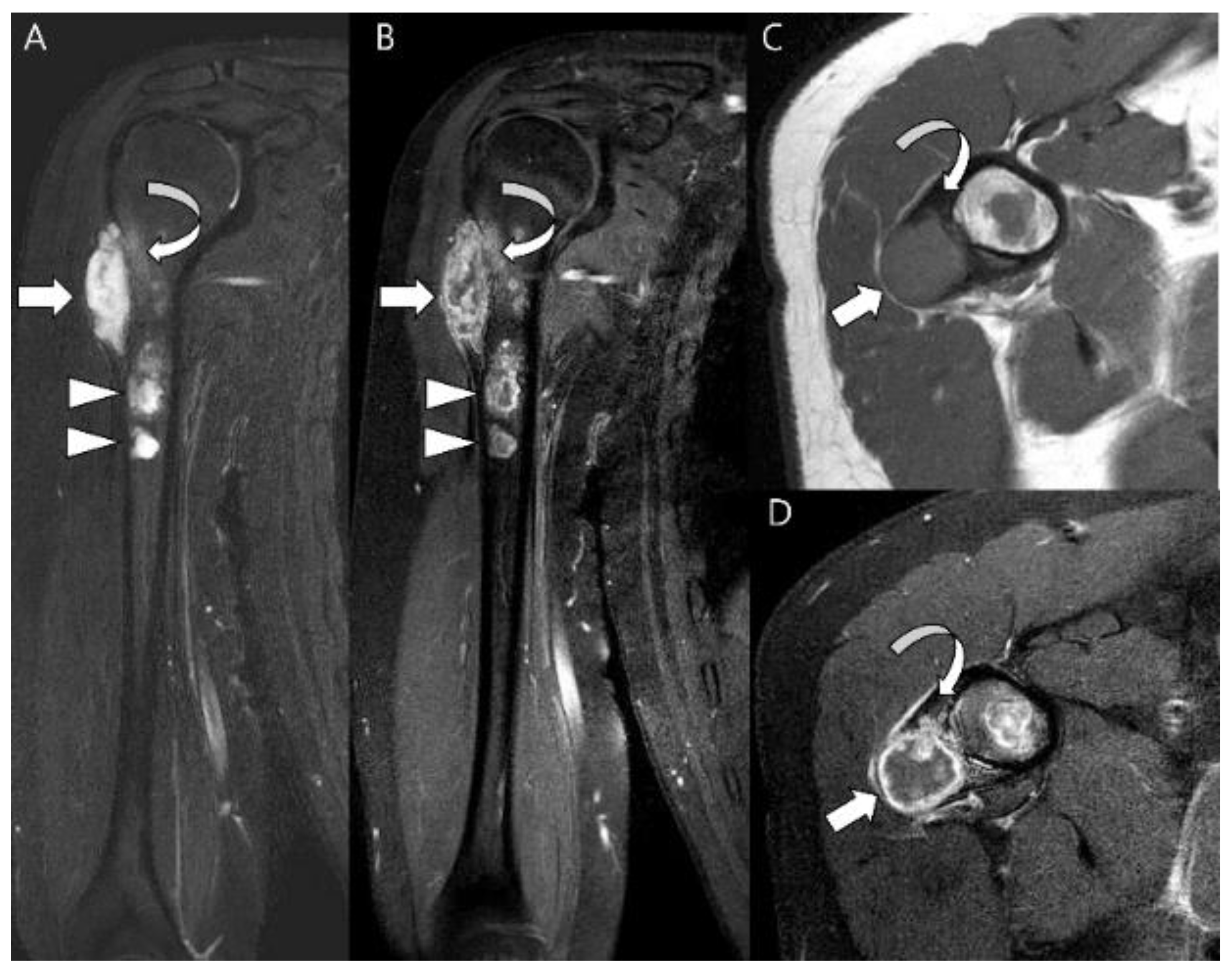 Cancers 15 01703 g009 Cancers 15 01703 g009