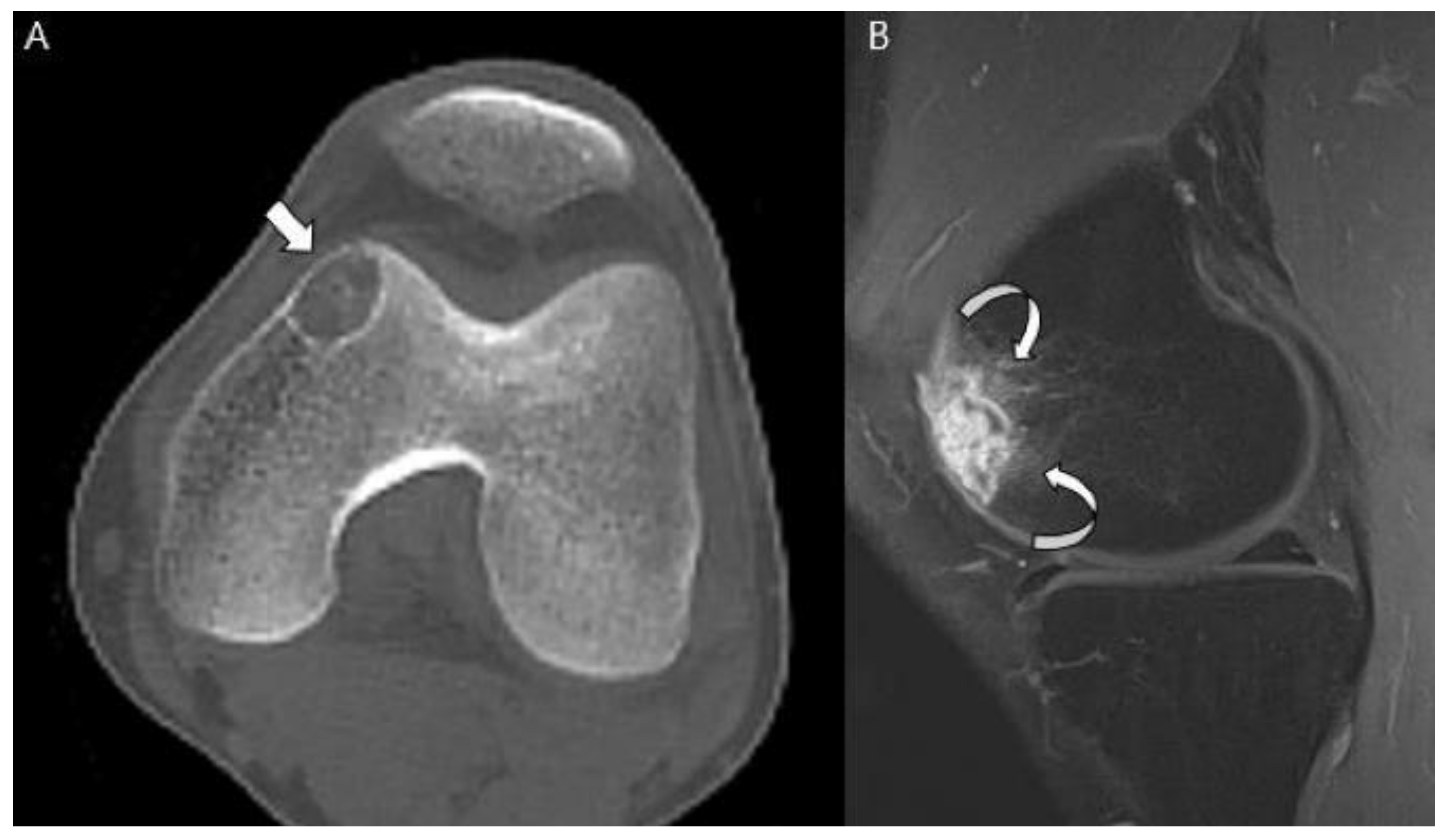 Cancers 15 01703 g012 Cancers 15 01703 g012