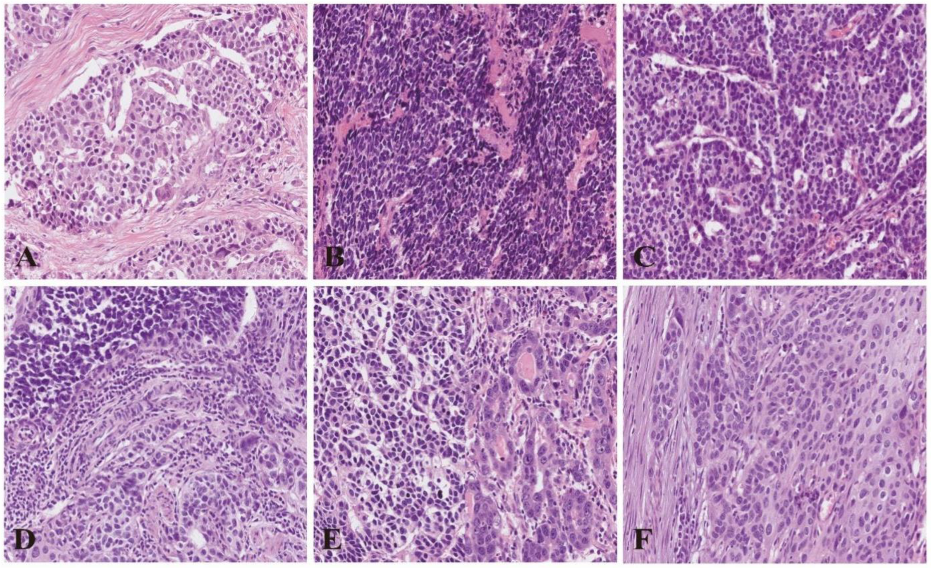 Cancers 15 01732 g003 Cancers 15 01732 g003