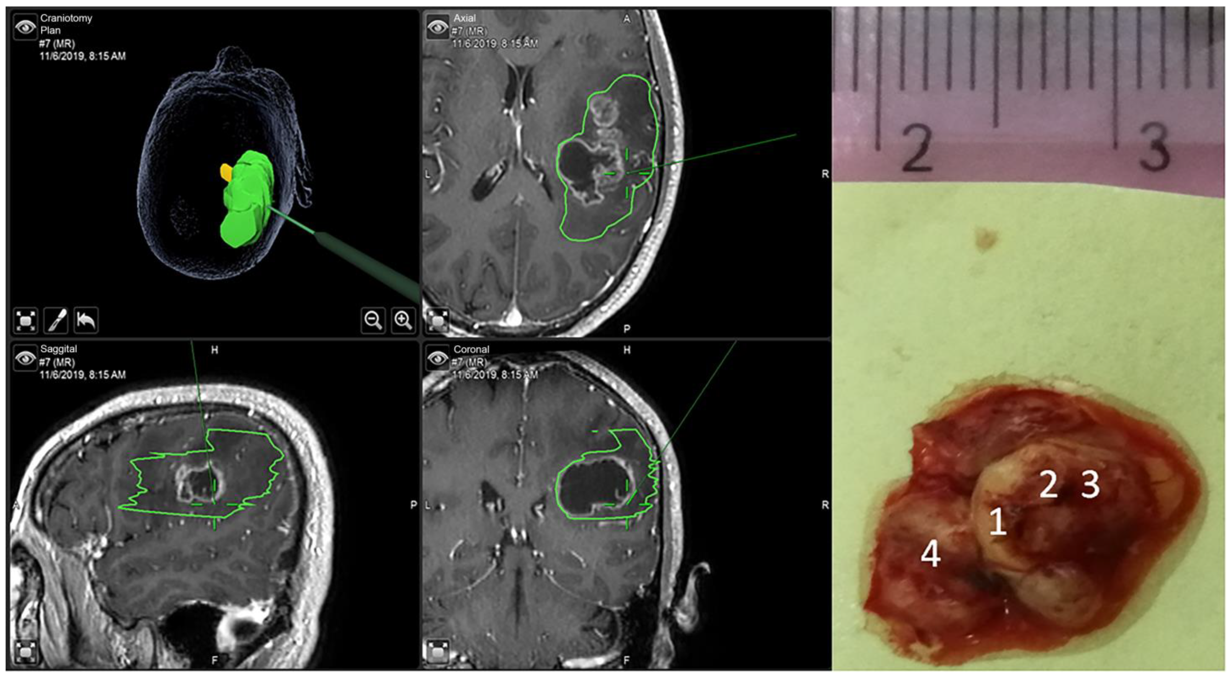 Cancers 15 01752 g002