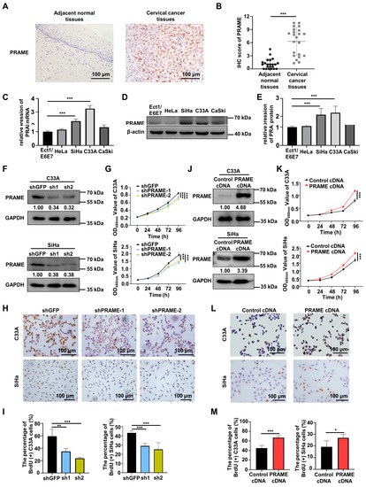 PRAME Promotes Cervical Cancer Proliferation and Migration via Wnt/β ...