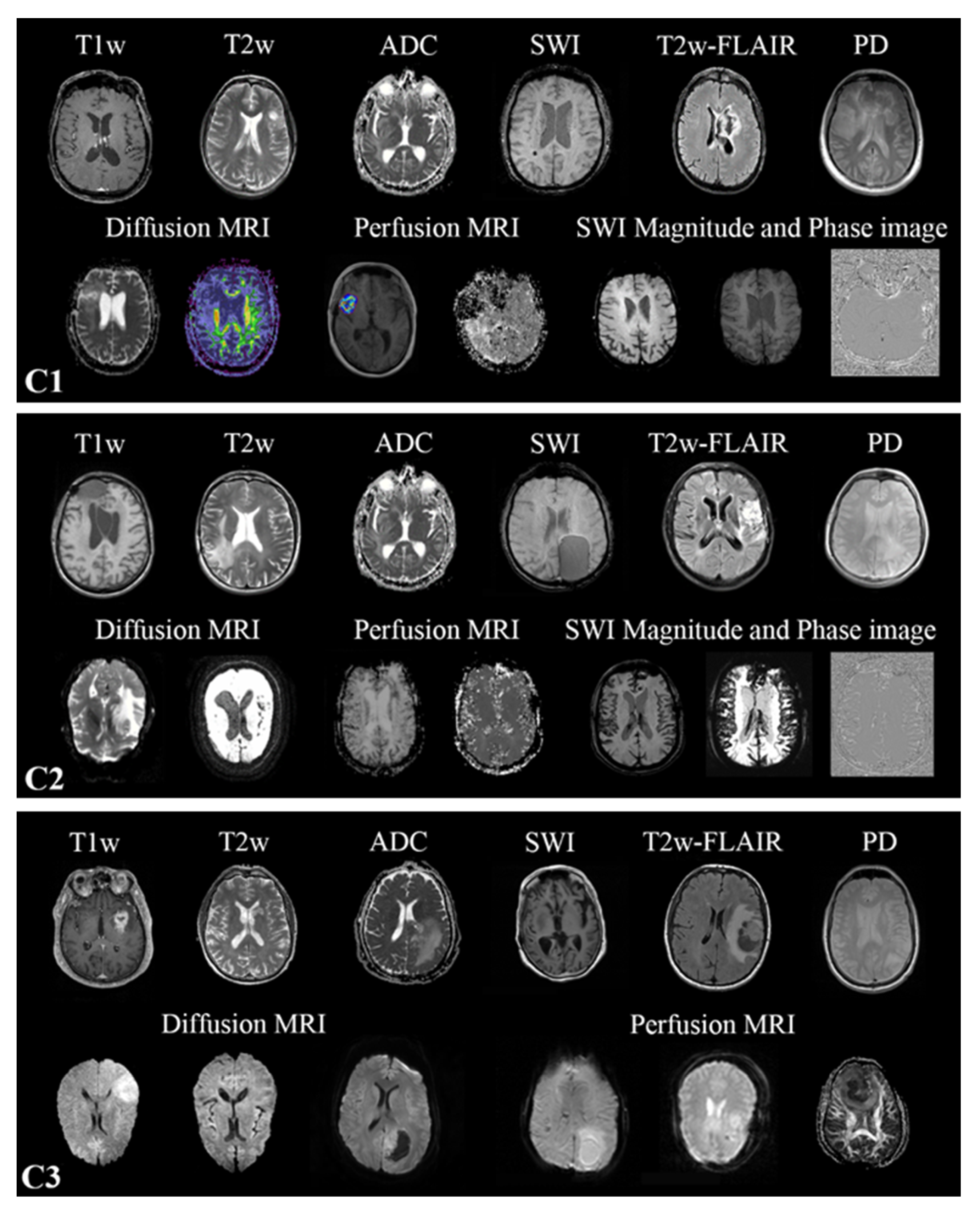 Cancers 15 01820 g001