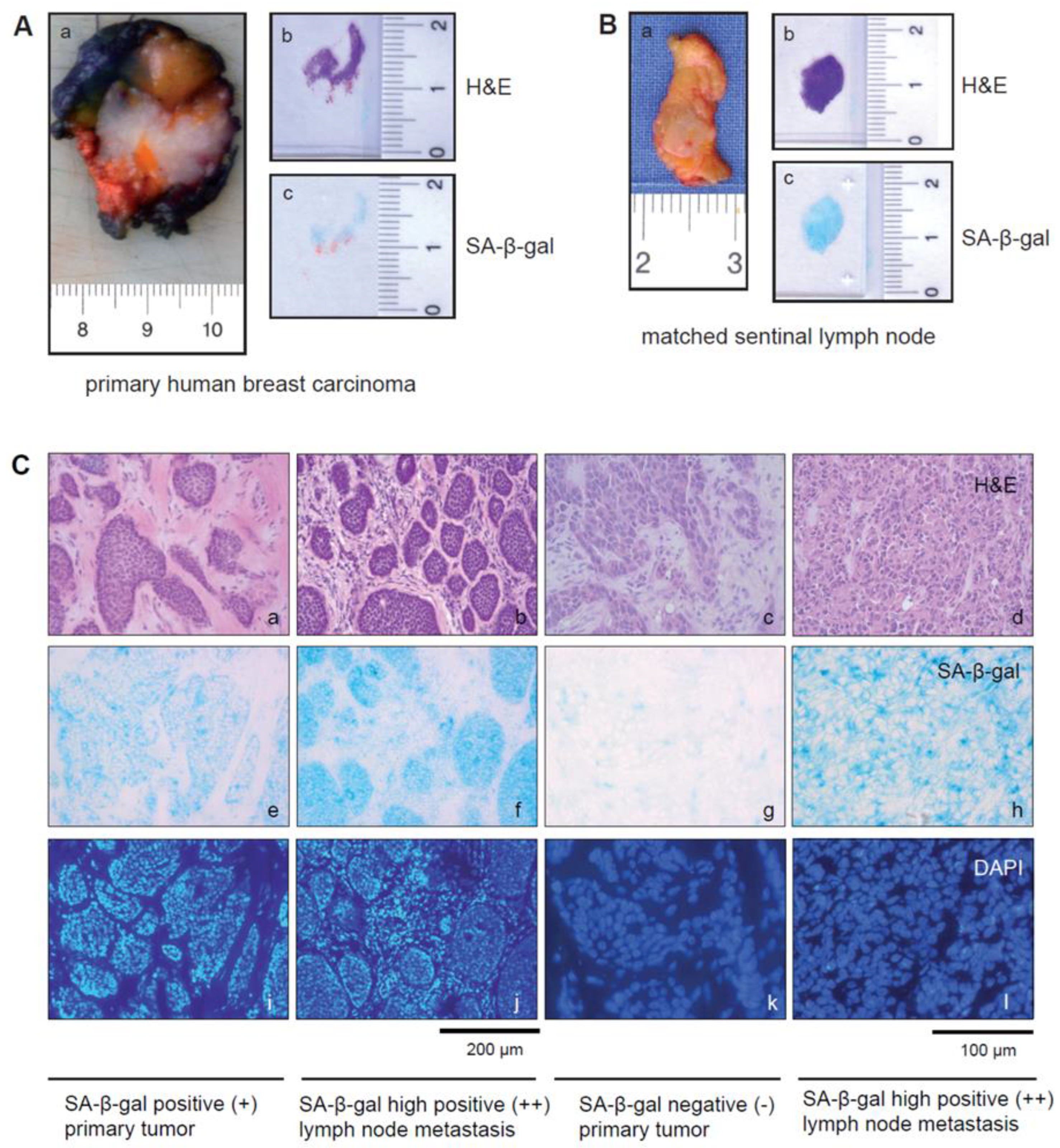 Cancers 15 01860 g001