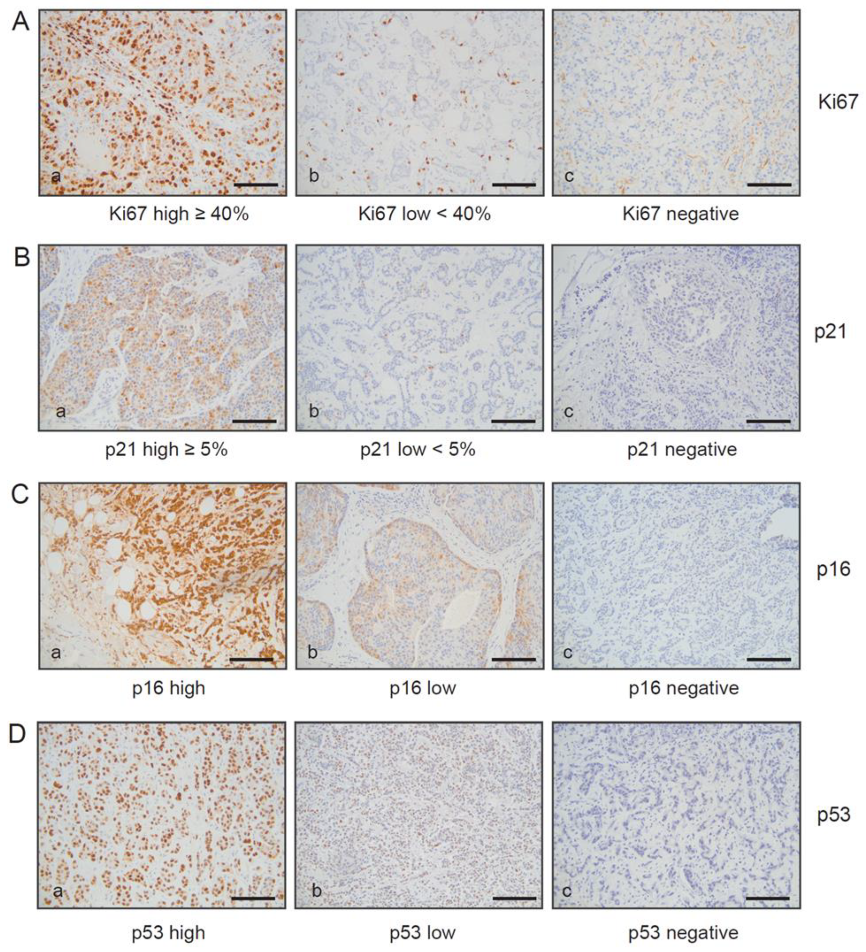 Cancers 15 01860 g004