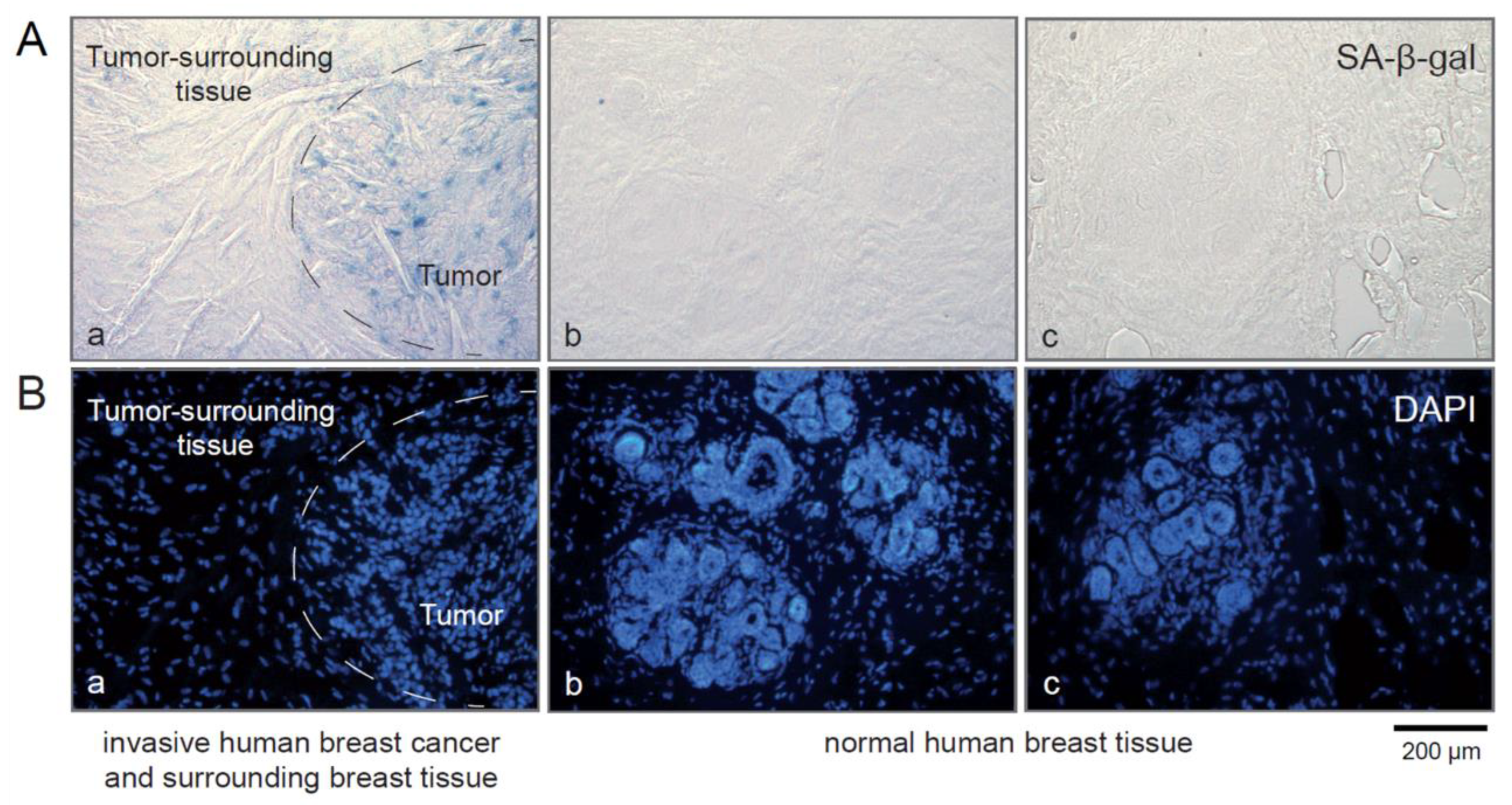 Cancers 15 01860 g005