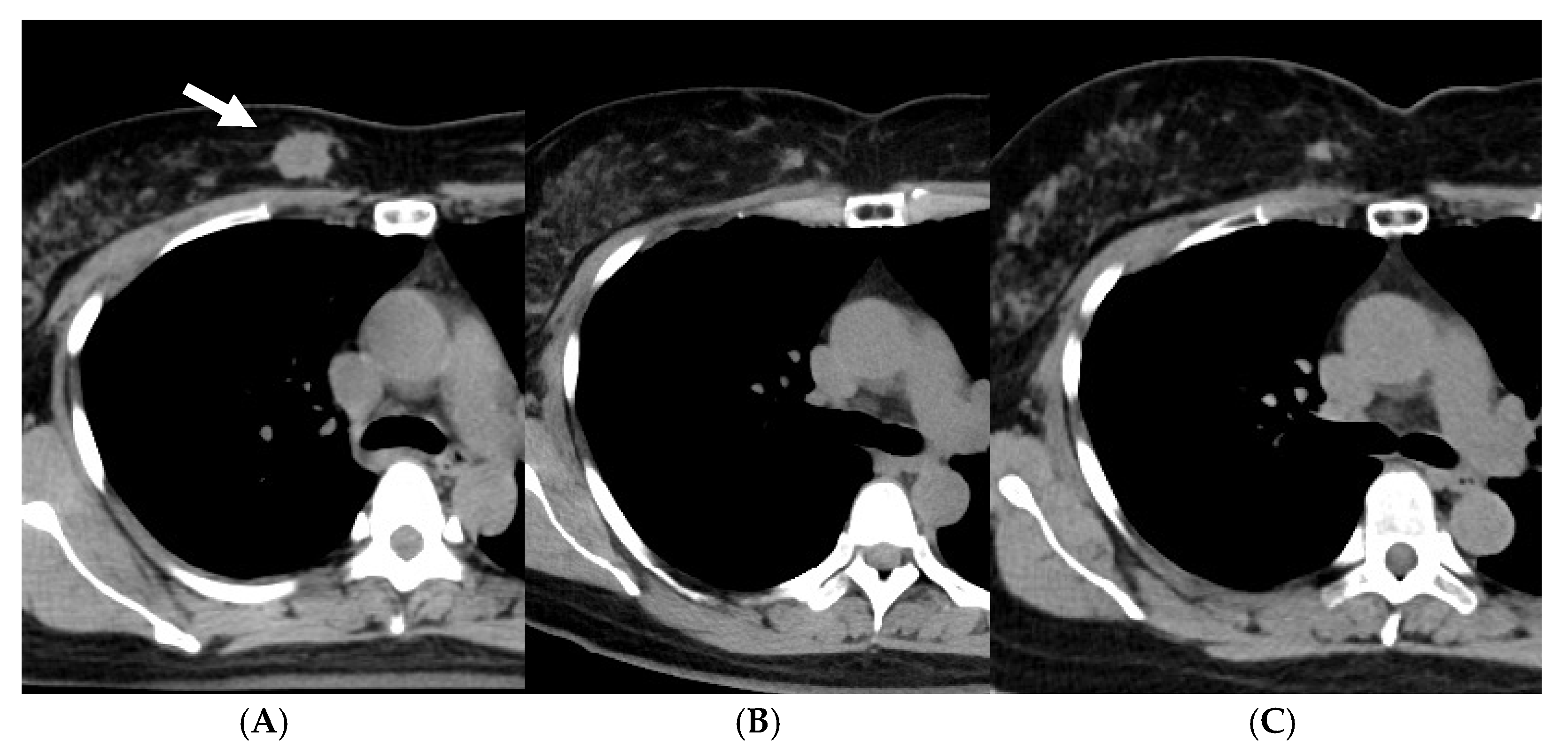 Cancers 15 01864 g002 Cancers 15 01864 g002