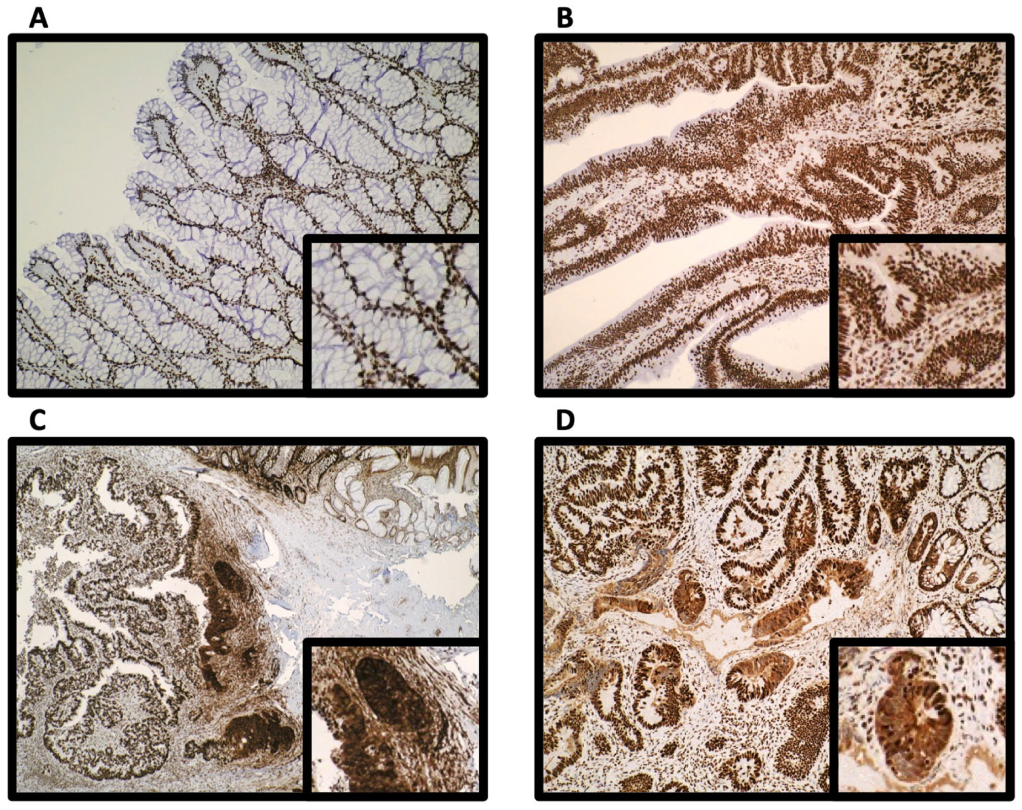 Cancers 15 01865 g001