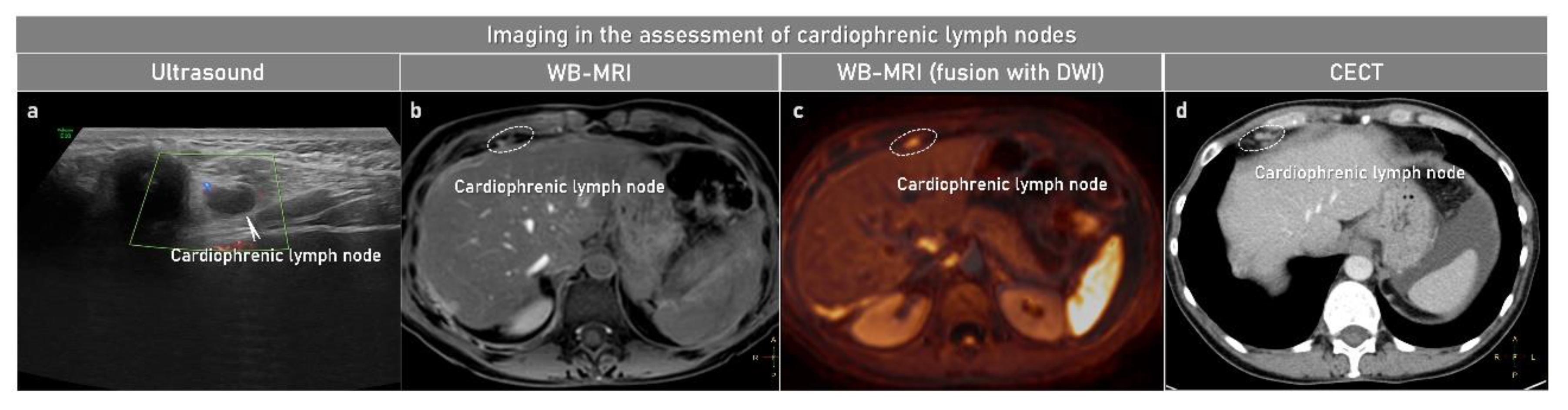 Cancers 15 01904 g006